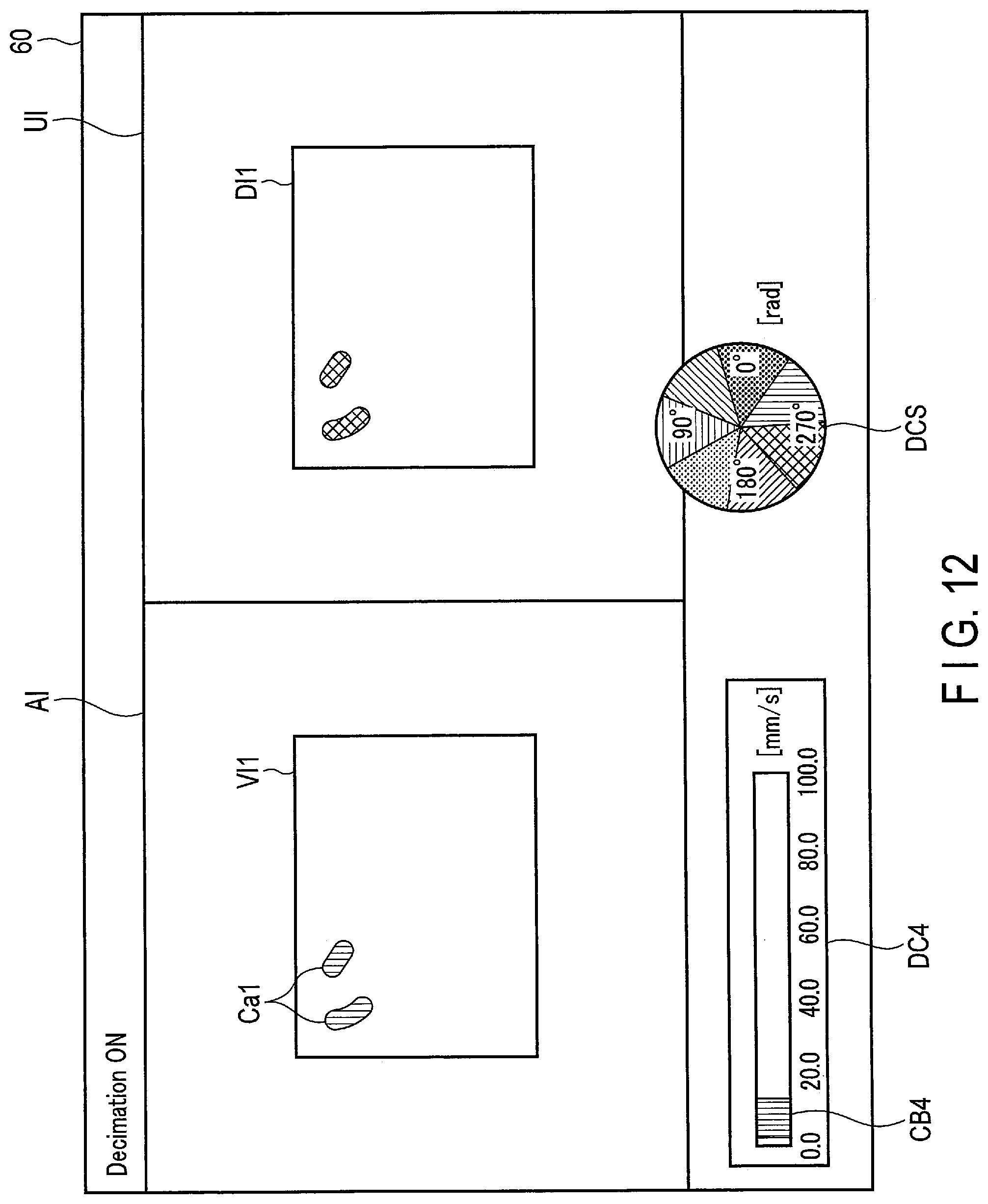 Patent US12307688 Figure 8 – Analysis apparatus and ultrasound diagnosis apparatus