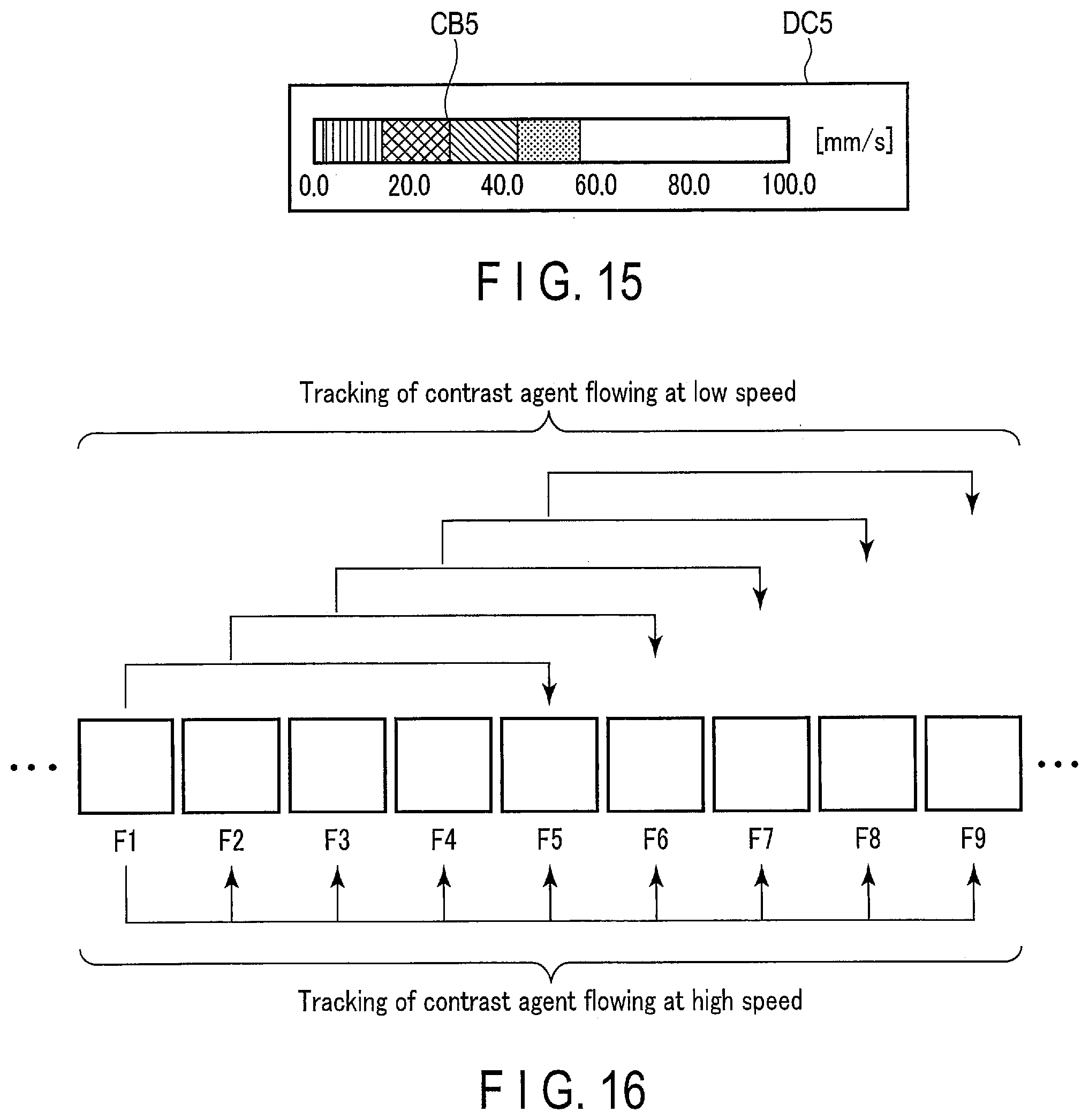Patent US12307688 Figure 11 – Analysis apparatus and ultrasound diagnosis apparatus