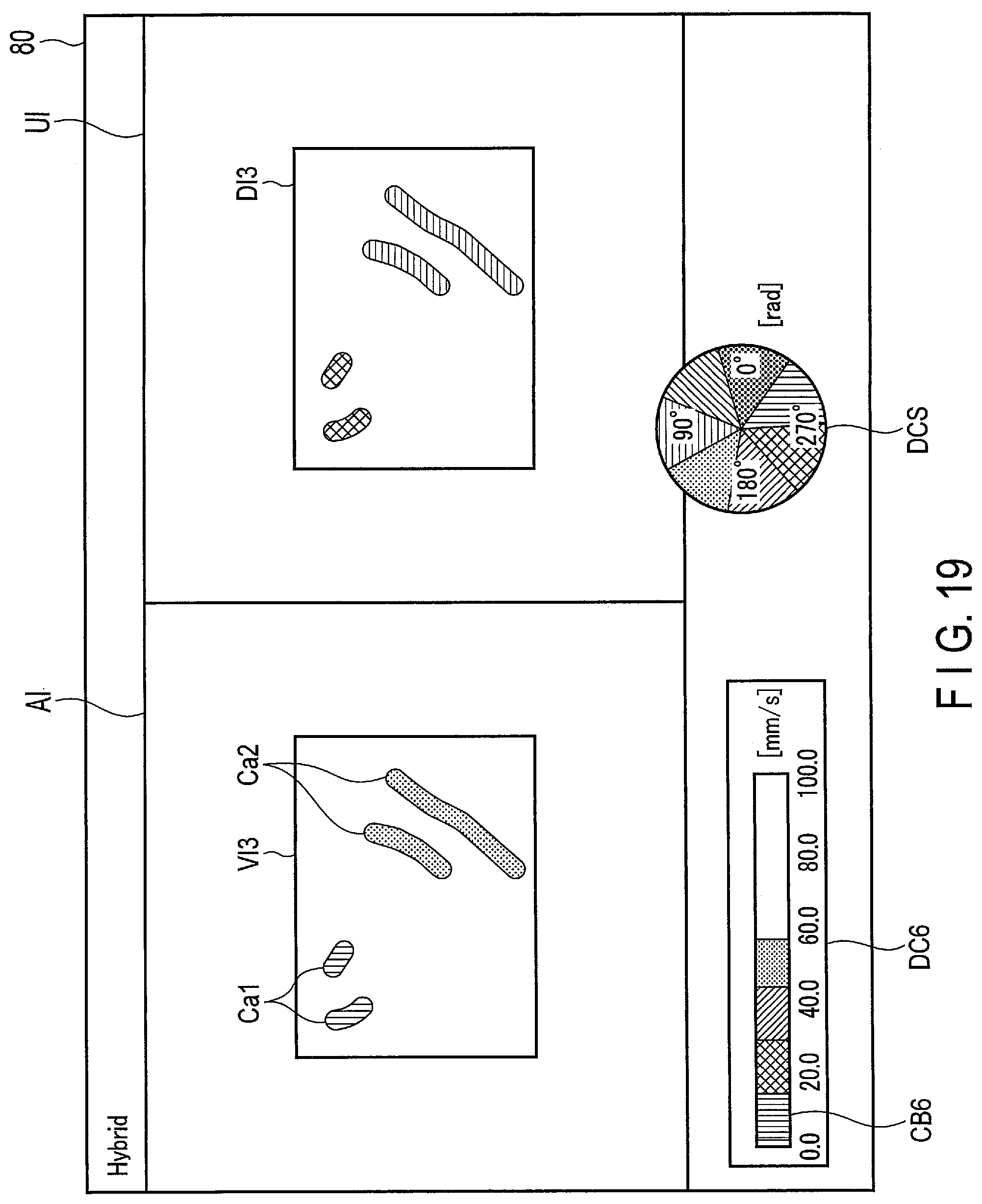 Patent US12307688 Figure 14 – Analysis apparatus and ultrasound diagnosis apparatus