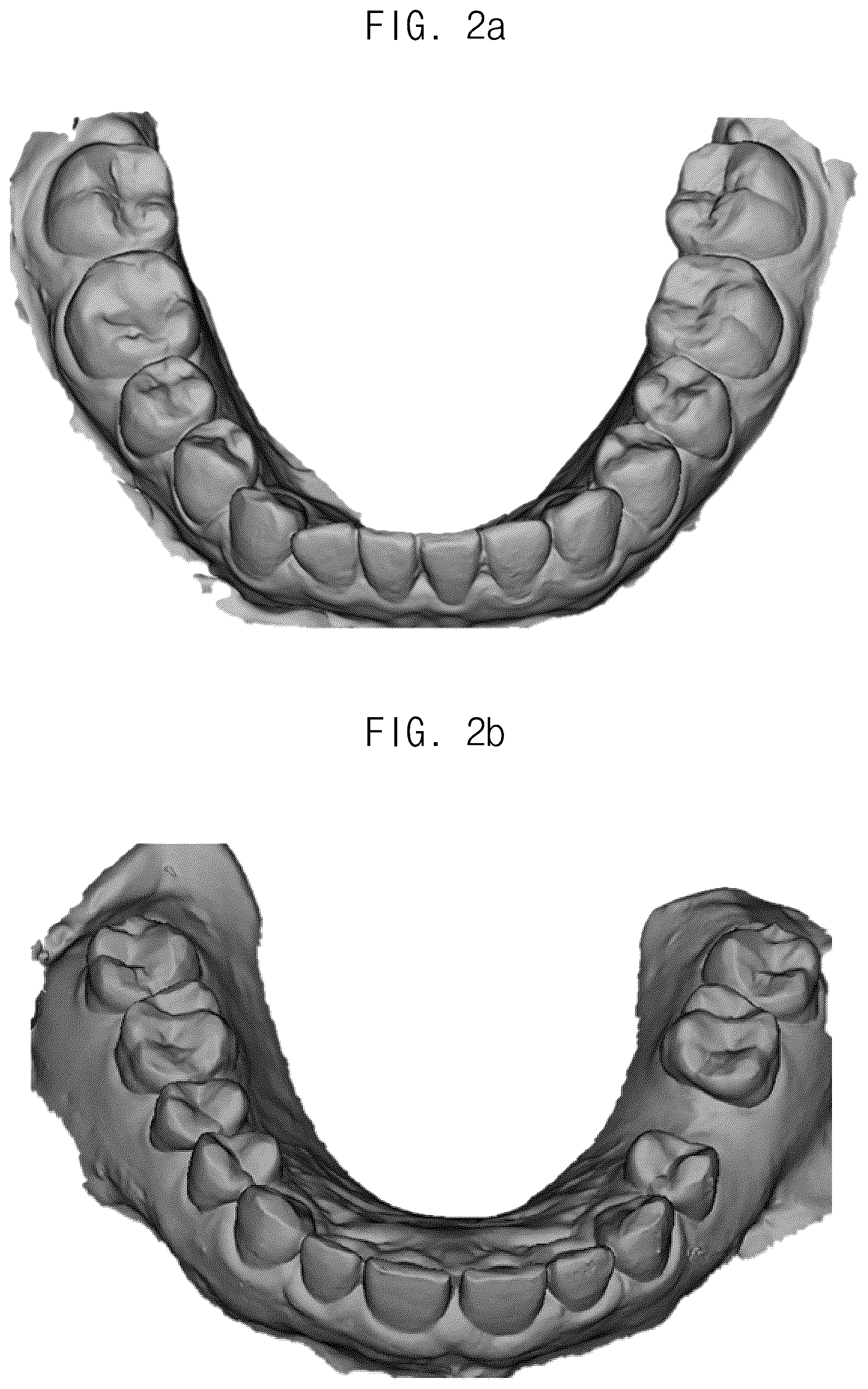 Patent US12307693 Figure 2 – Automated method for aligning three dimensional dental library model to three dimensional oral scan data and computer readable medium having program for performing the method