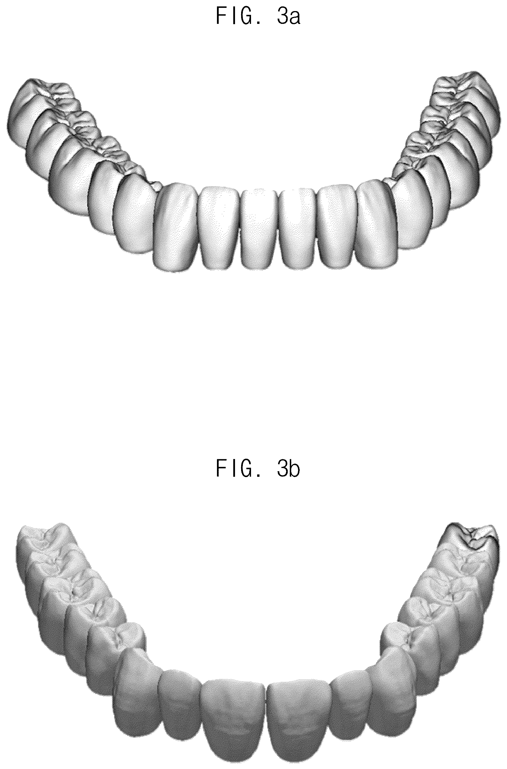 Patent US12307693 Figure 3 – Automated method for aligning three dimensional dental library model to three dimensional oral scan data and computer readable medium having program for performing the method
