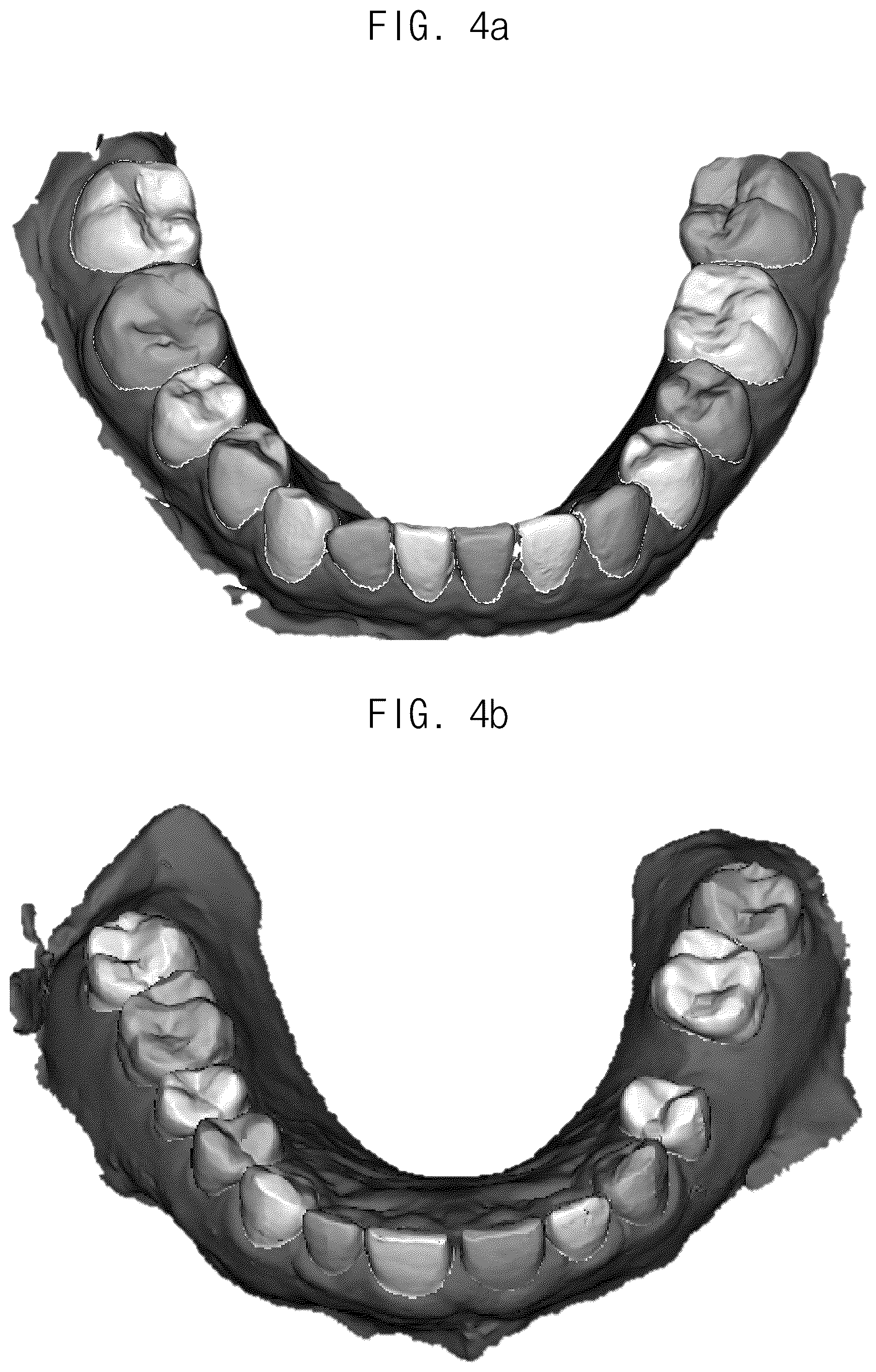Patent US12307693 Figure 4 – Automated method for aligning three dimensional dental library model to three dimensional oral scan data and computer readable medium having program for performing the method