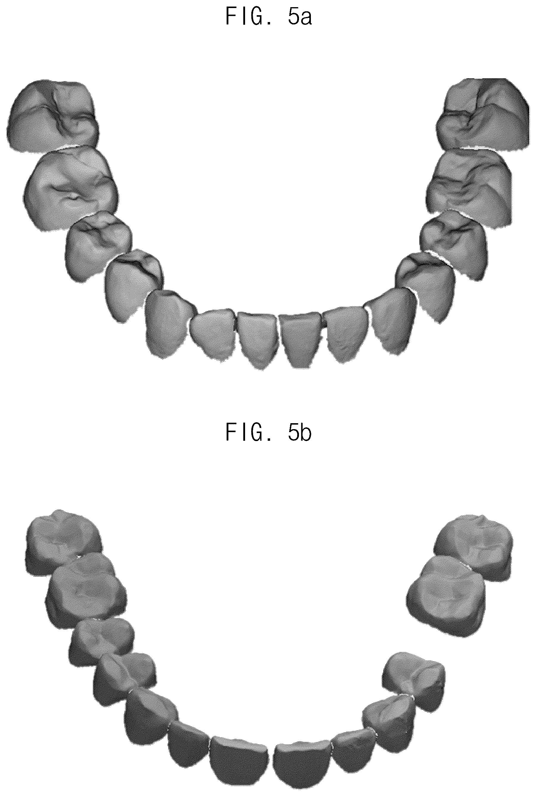 Patent US12307693 Figure 5 – Automated method for aligning three dimensional dental library model to three dimensional oral scan data and computer readable medium having program for performing the method