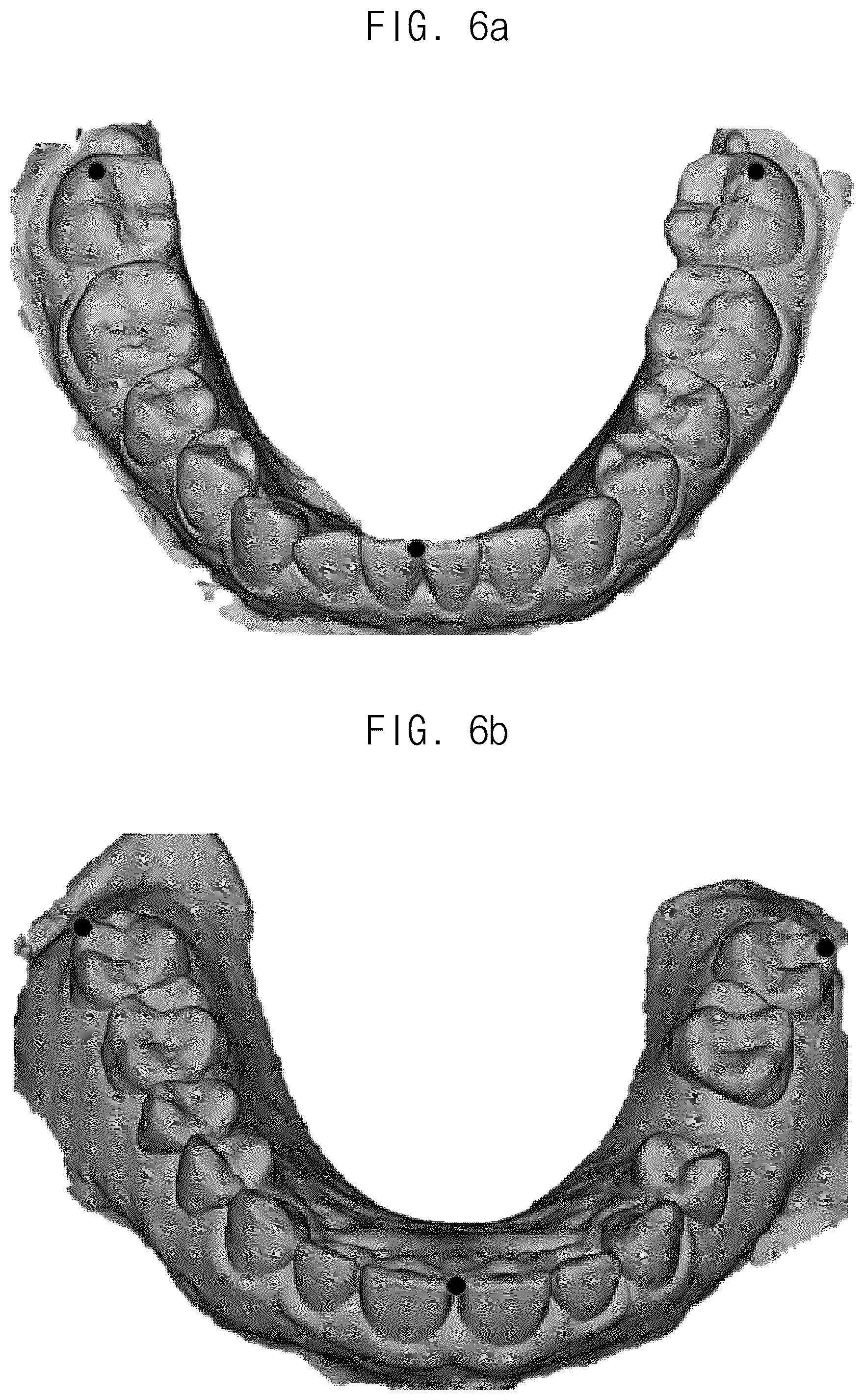 Patent US12307693 Figure 6 – Automated method for aligning three dimensional dental library model to three dimensional oral scan data and computer readable medium having program for performing the method
