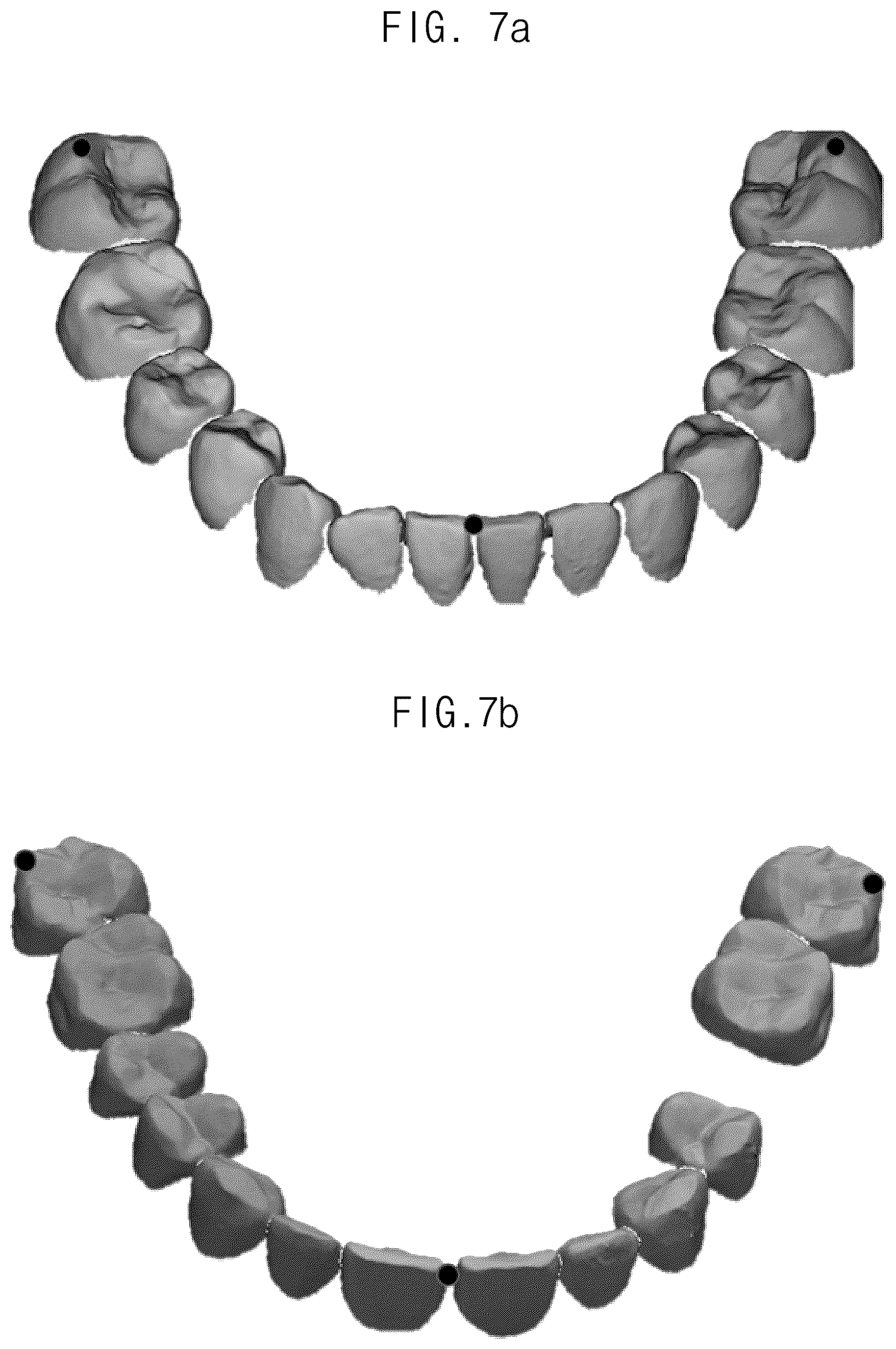 Patent US12307693 Figure 7 – Automated method for aligning three dimensional dental library model to three dimensional oral scan data and computer readable medium having program for performing the method