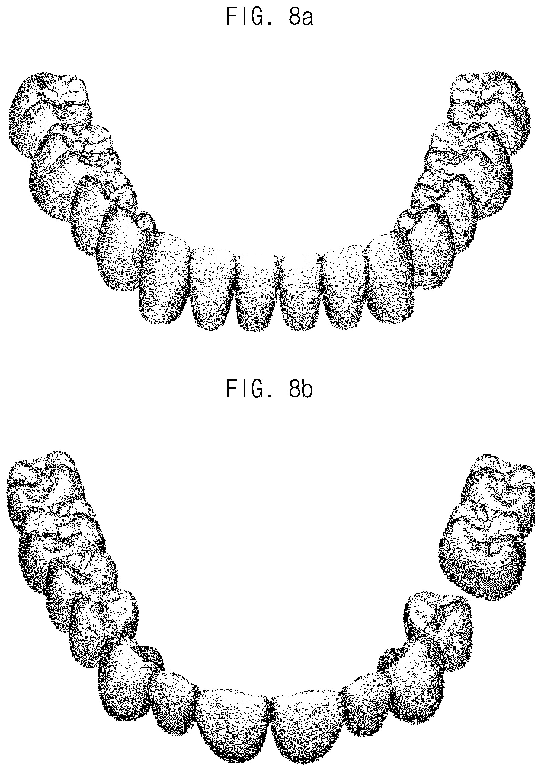 Patent US12307693 Figure 8 – Automated method for aligning three dimensional dental library model to three dimensional oral scan data and computer readable medium having program for performing the method