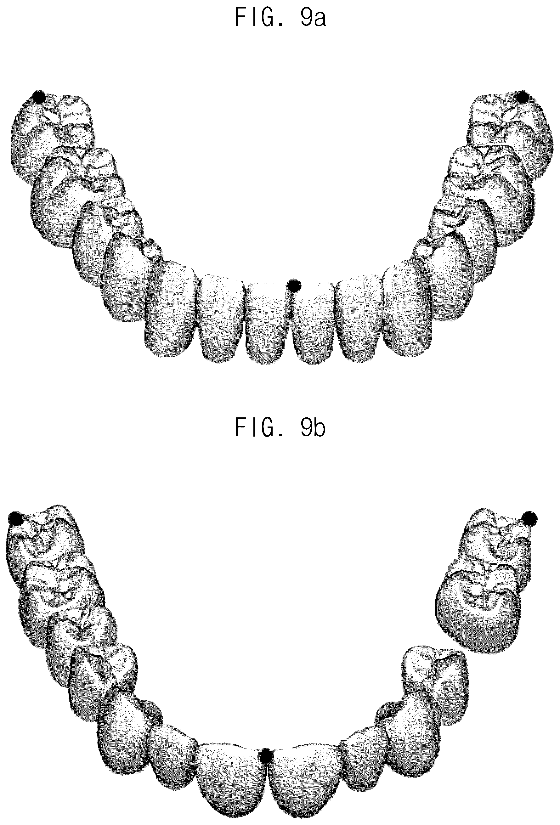 Patent US12307693 Figure 9 – Automated method for aligning three dimensional dental library model to three dimensional oral scan data and computer readable medium having program for performing the method