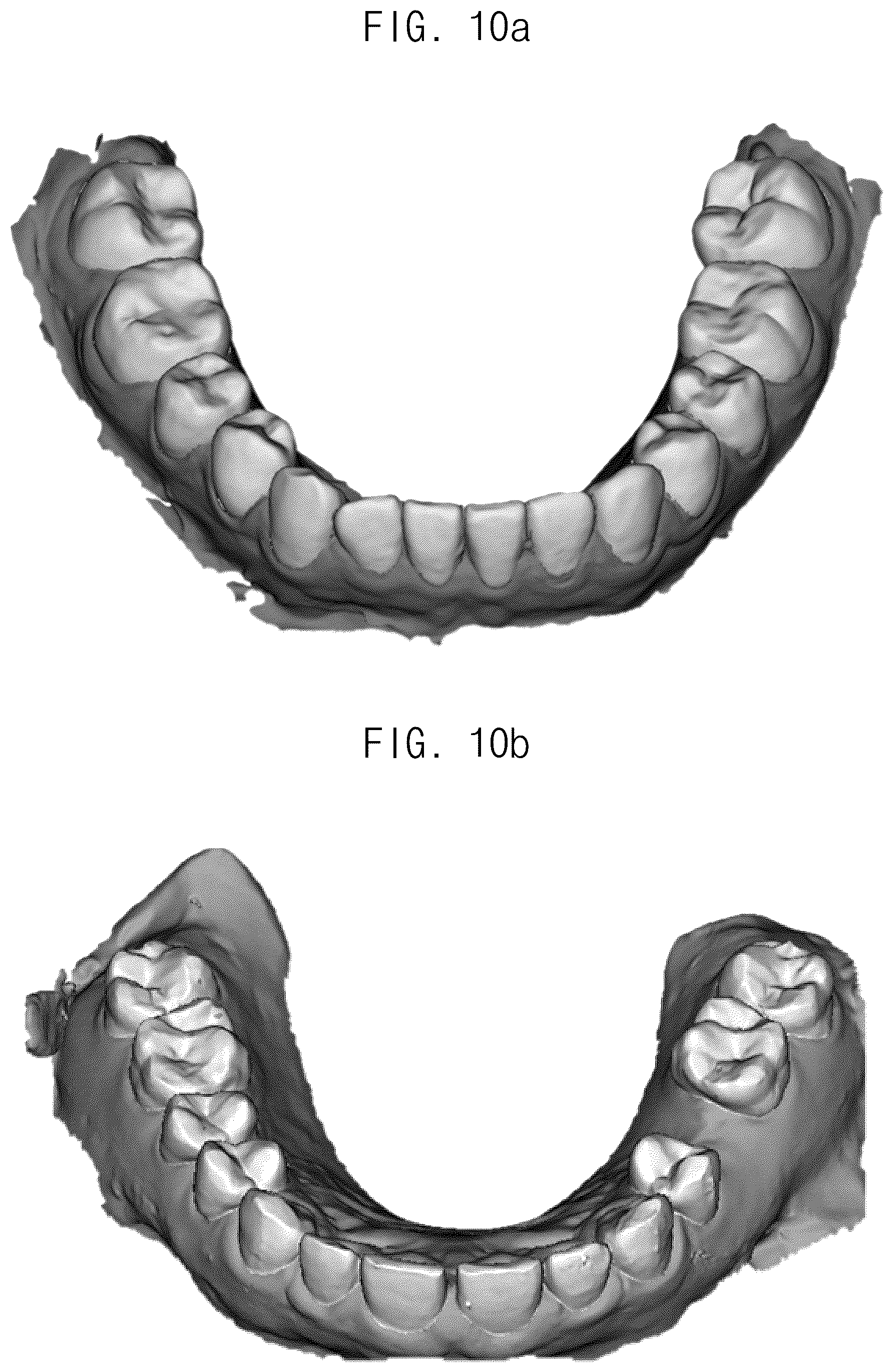 Patent US12307693 Figure 10 – Automated method for aligning three dimensional dental library model to three dimensional oral scan data and computer readable medium having program for performing the method