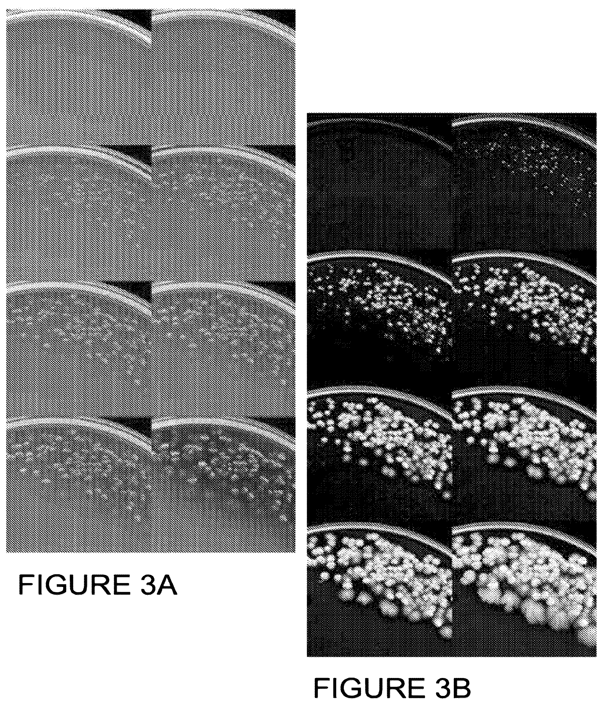 Patent US12307794 Figure 3 – System and method for monitoring bacterial growth of bacterial colonies and predicting colony biomass