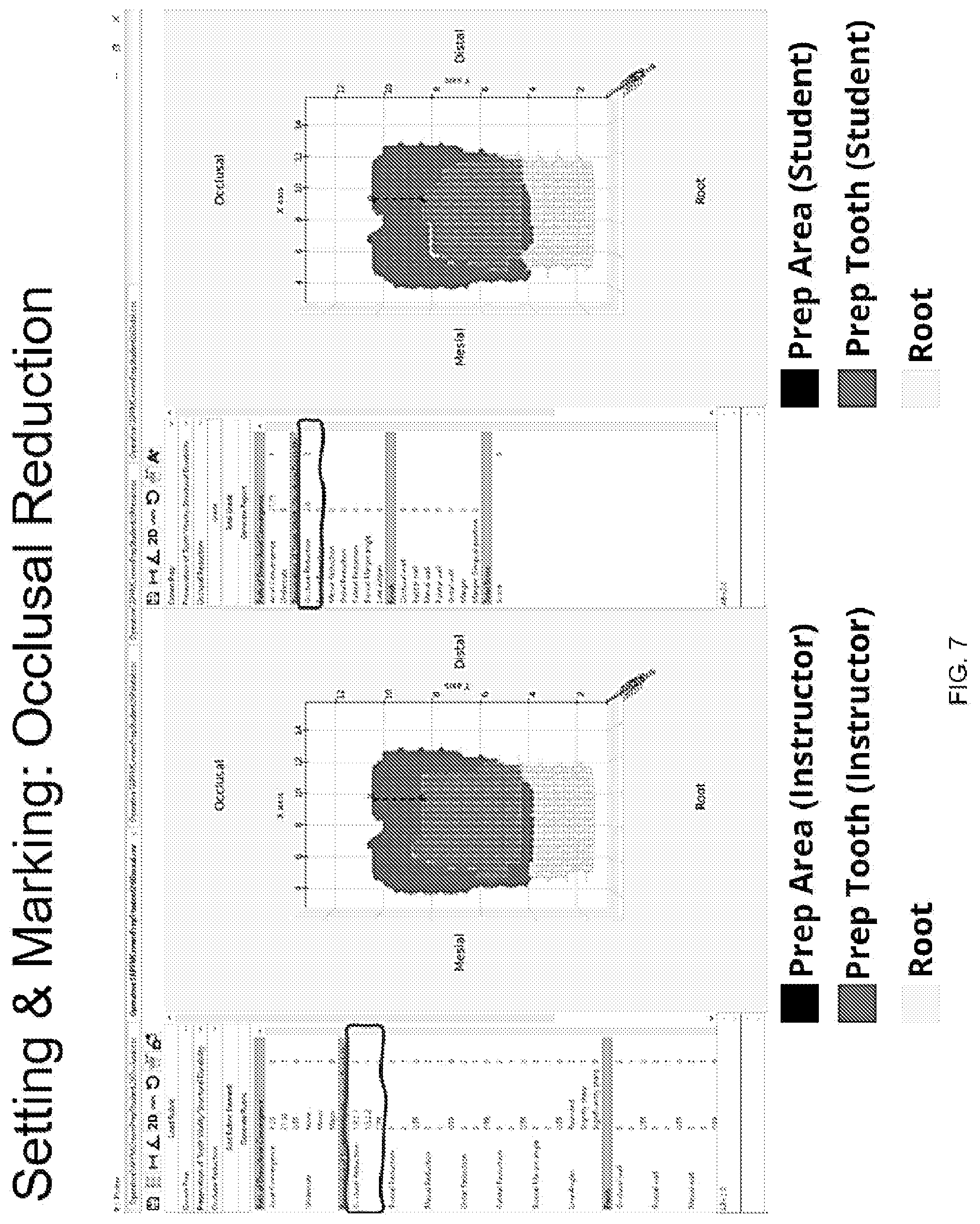 Patent US12307918 Figure 7 – Automated measurement apparatus and method for quantifying dimensions of dental preparation