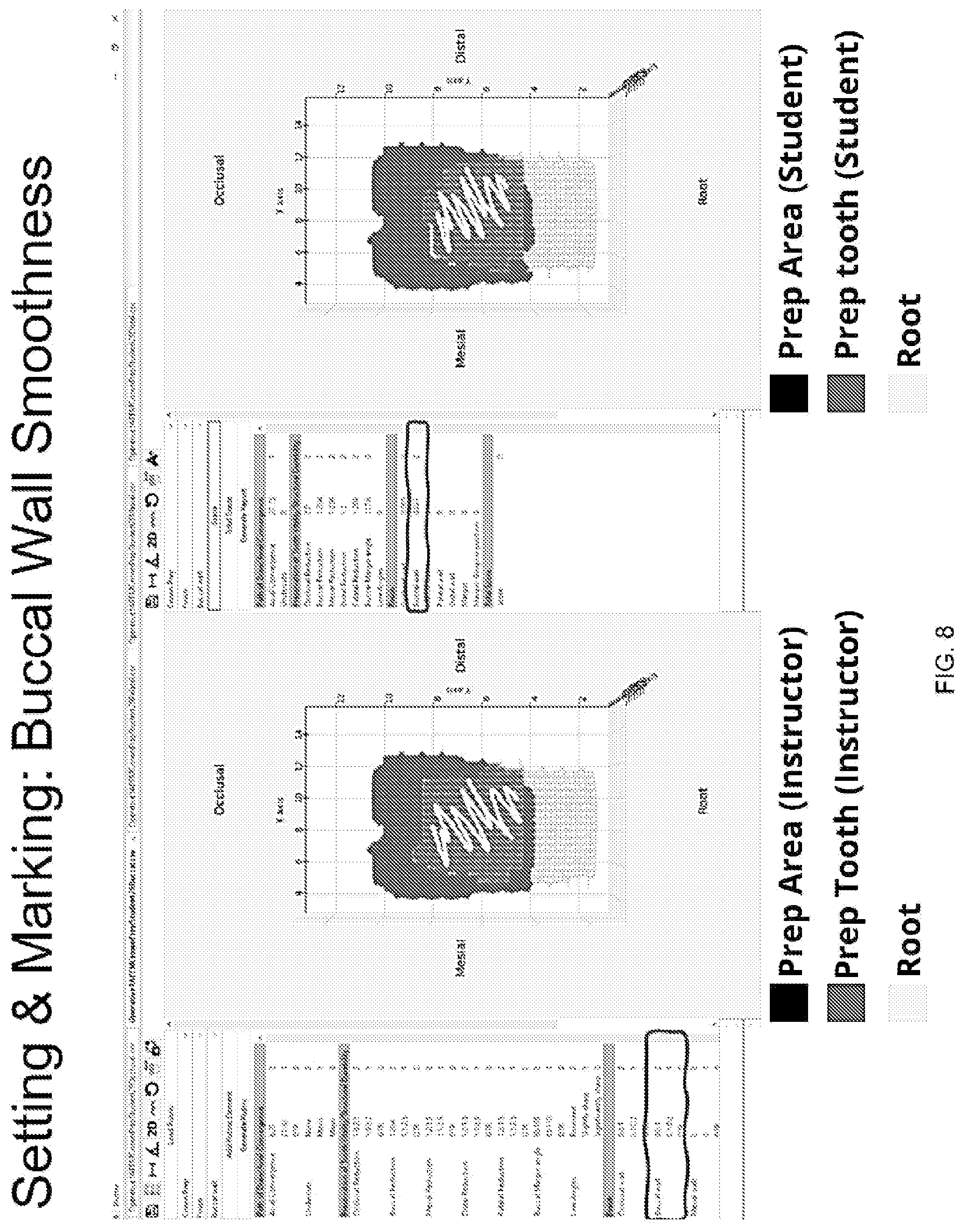 Patent US12307918 Figure 8 – Automated measurement apparatus and method for quantifying dimensions of dental preparation