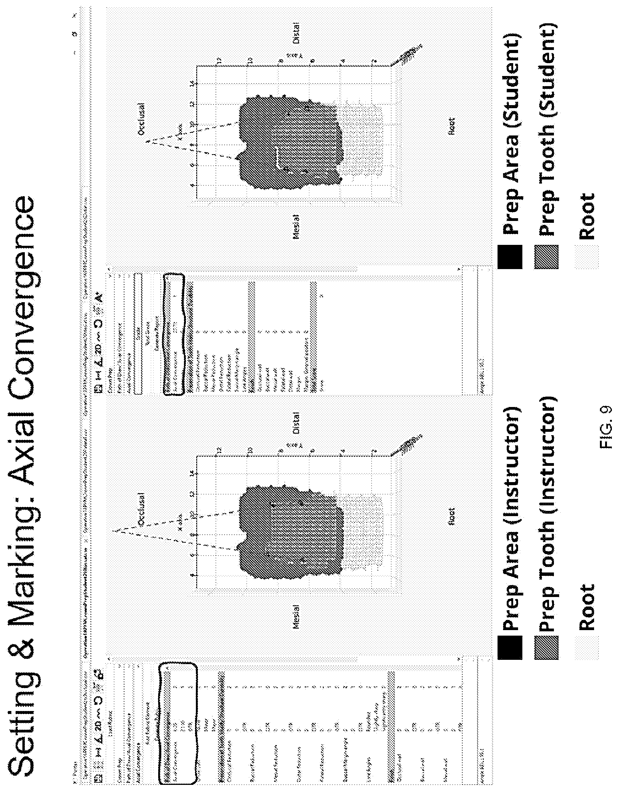 Patent US12307918 Figure 9 – Automated measurement apparatus and method for quantifying dimensions of dental preparation