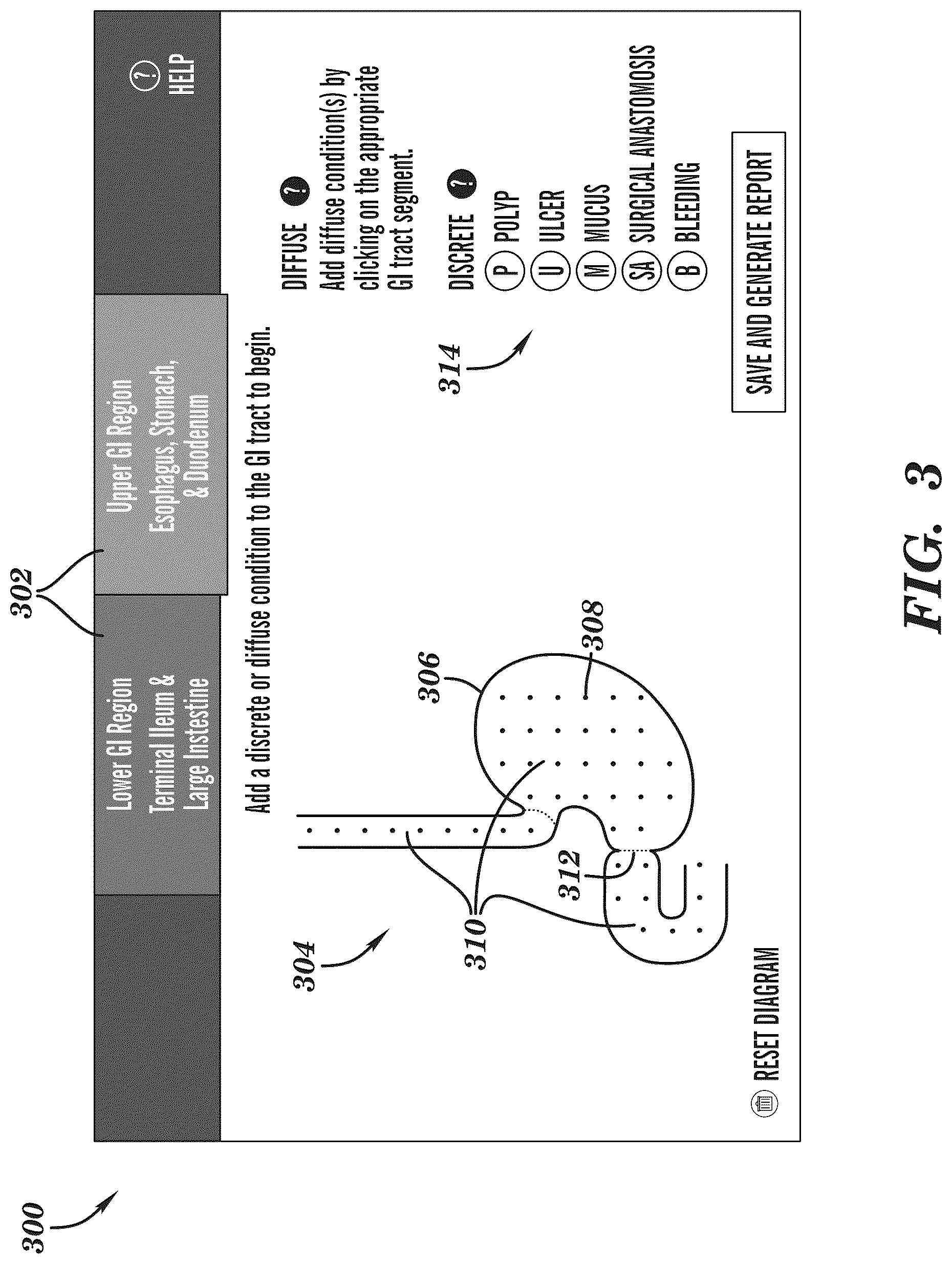 Patent US12308099 Figure 3 – Extended reality medical report generating system