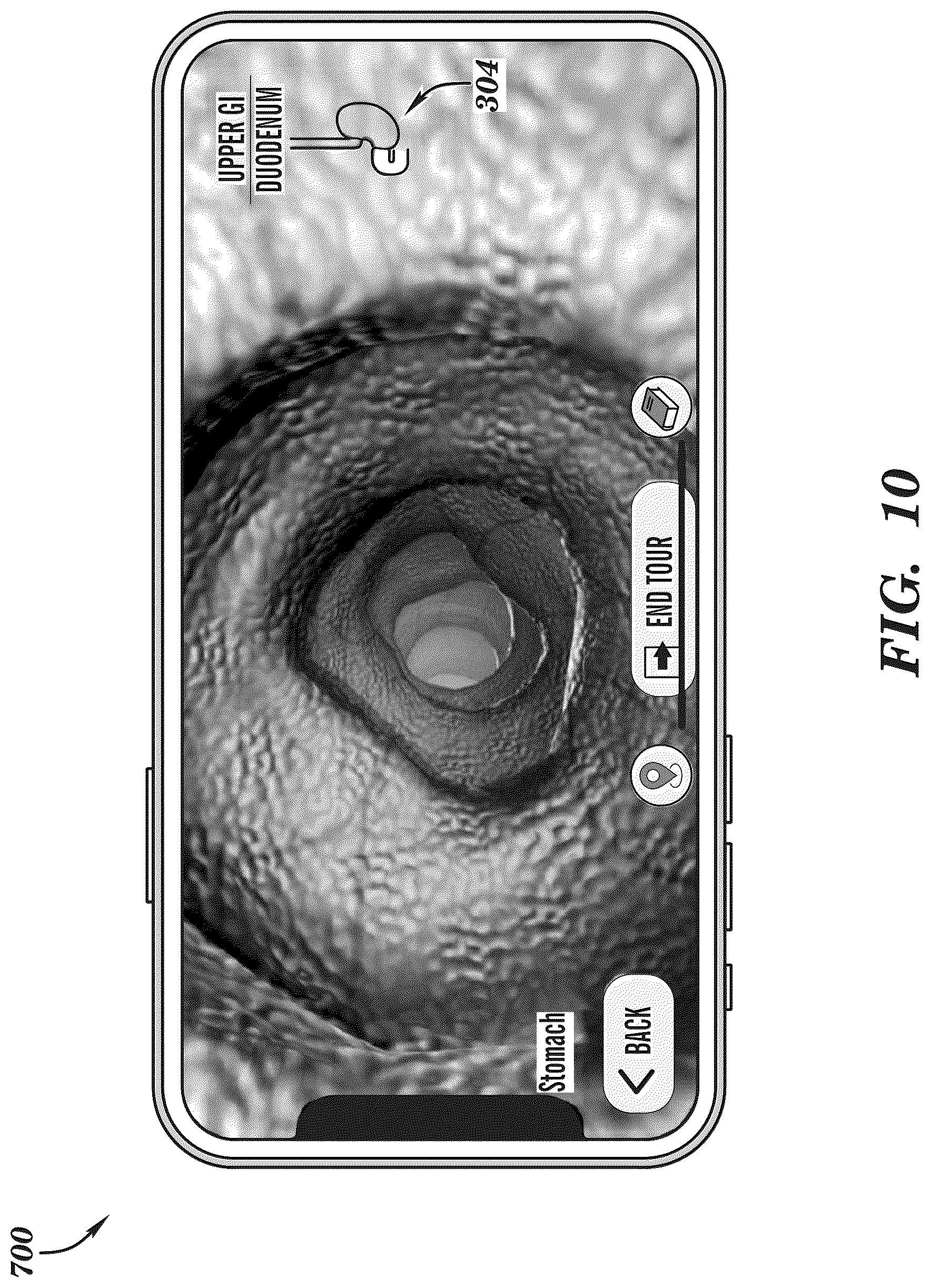 Patent US12308099 Figure 10 – Extended reality medical report generating system