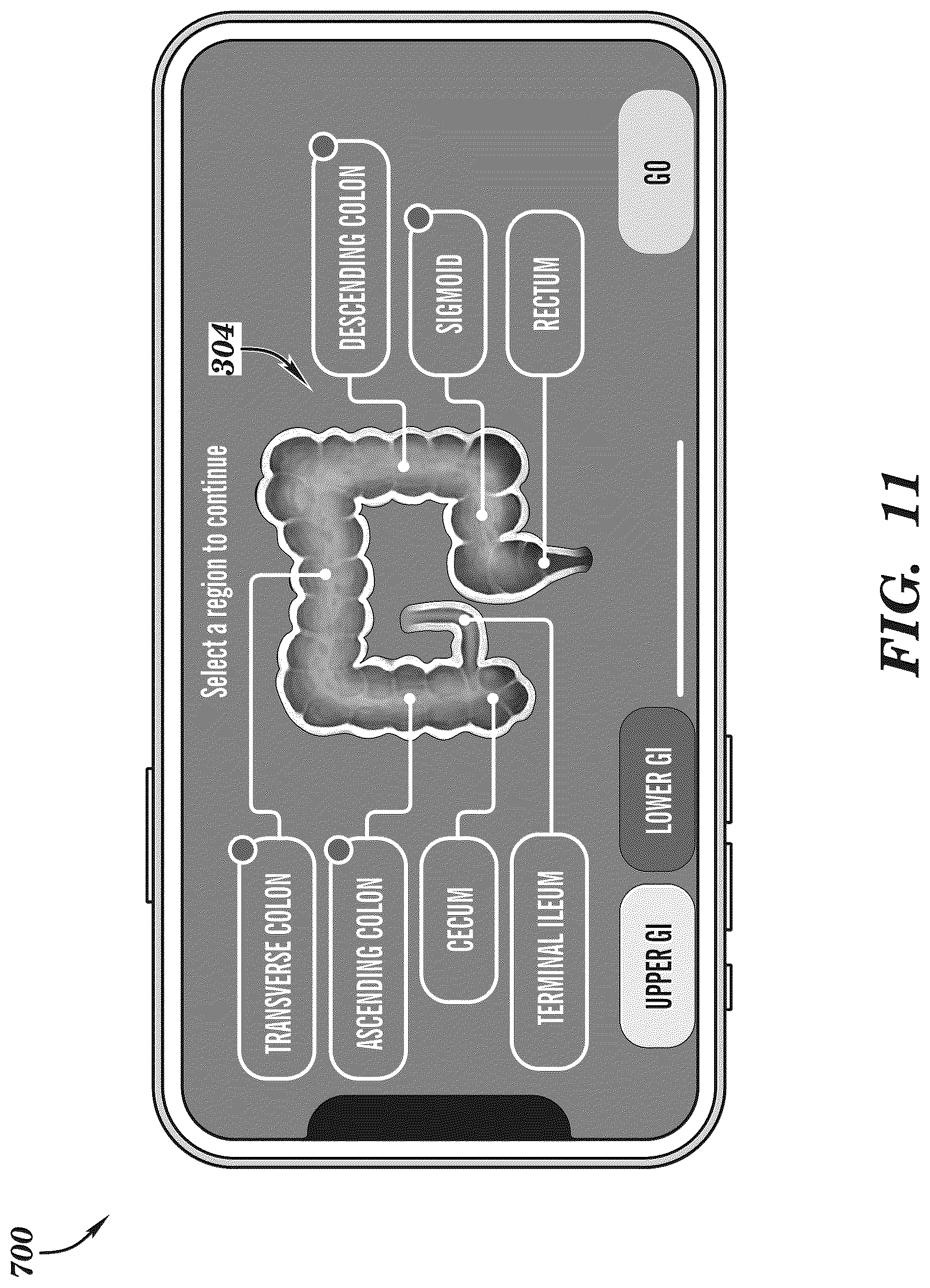 Patent US12308099 Figure 11 – Extended reality medical report generating system