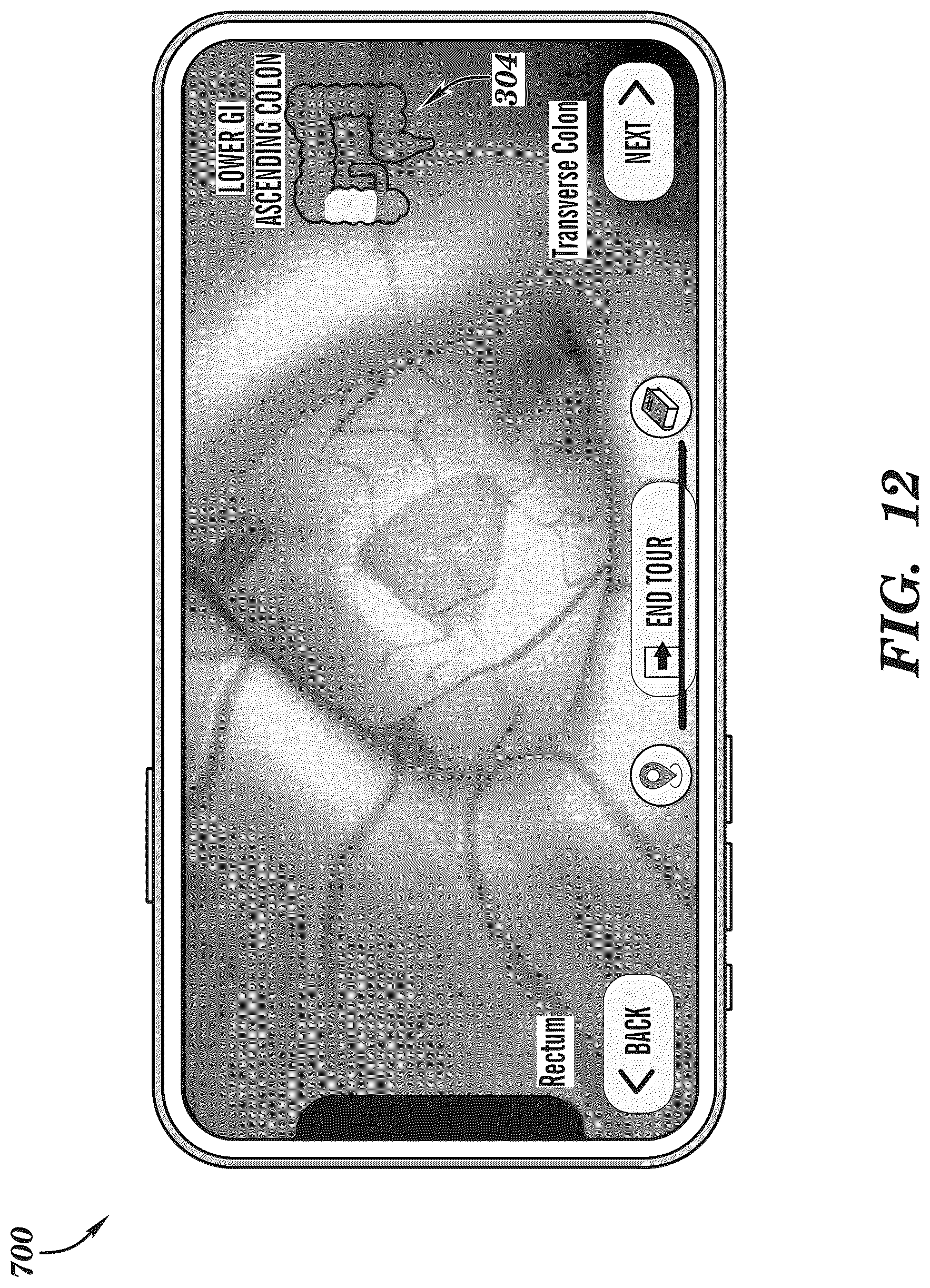 Patent US12308099 Figure 12 – Extended reality medical report generating system