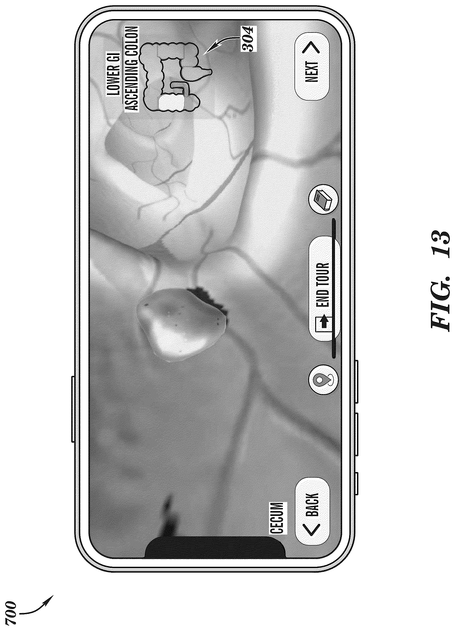 Patent US12308099 Figure 13 – Extended reality medical report generating system