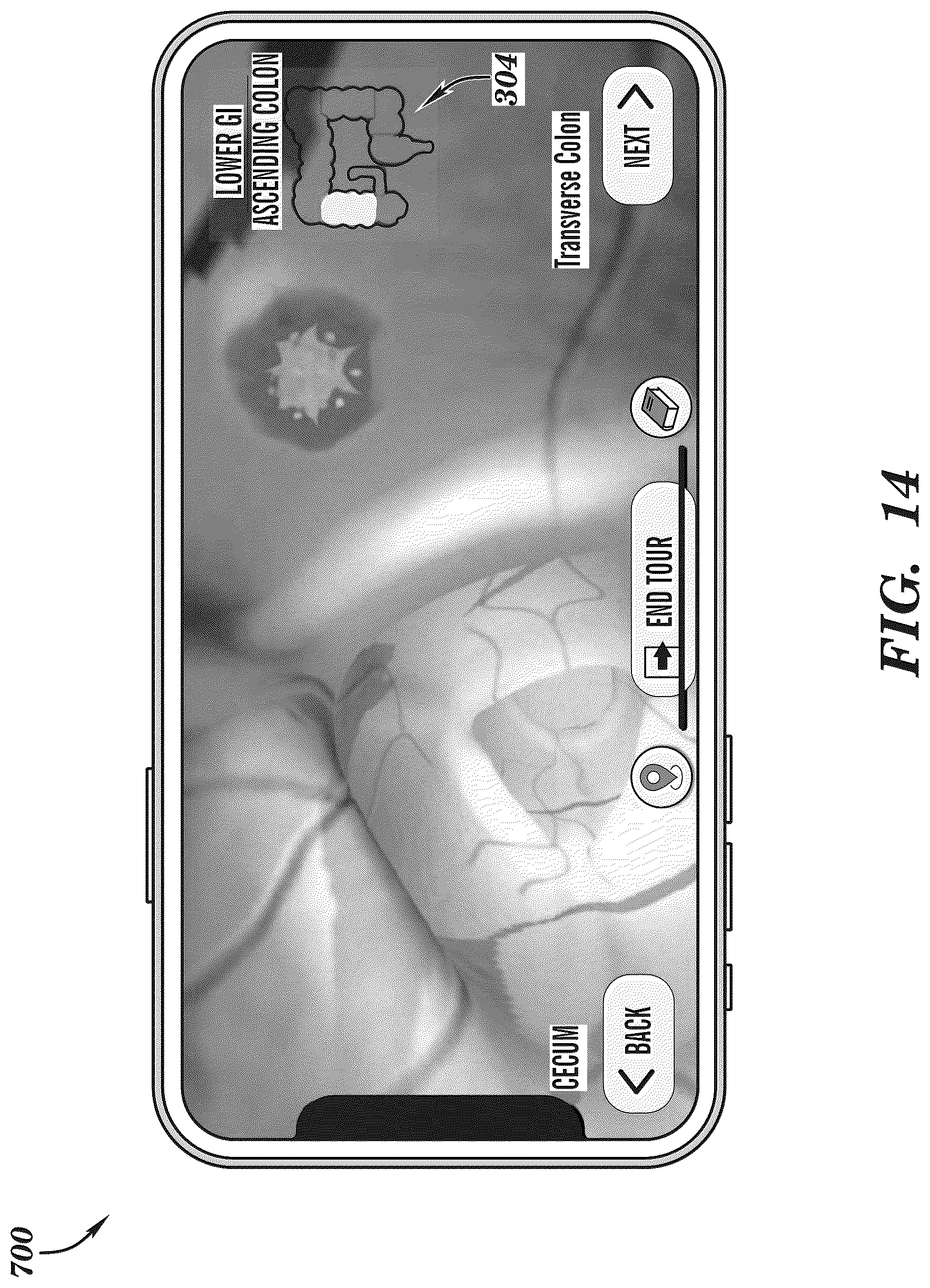 Patent US12308099 Figure 14 – Extended reality medical report generating system