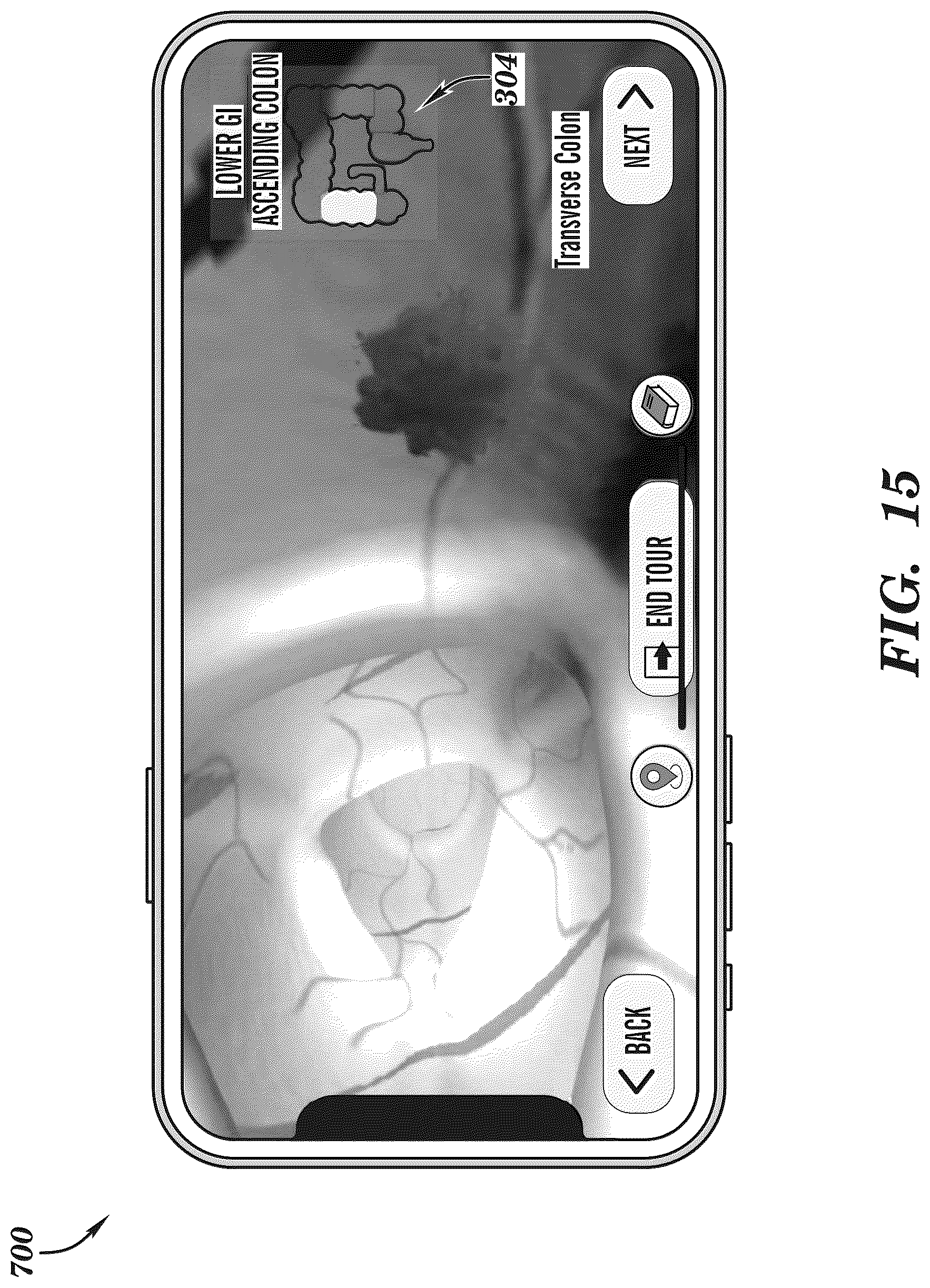 Patent US12308099 Figure 15 – Extended reality medical report generating system