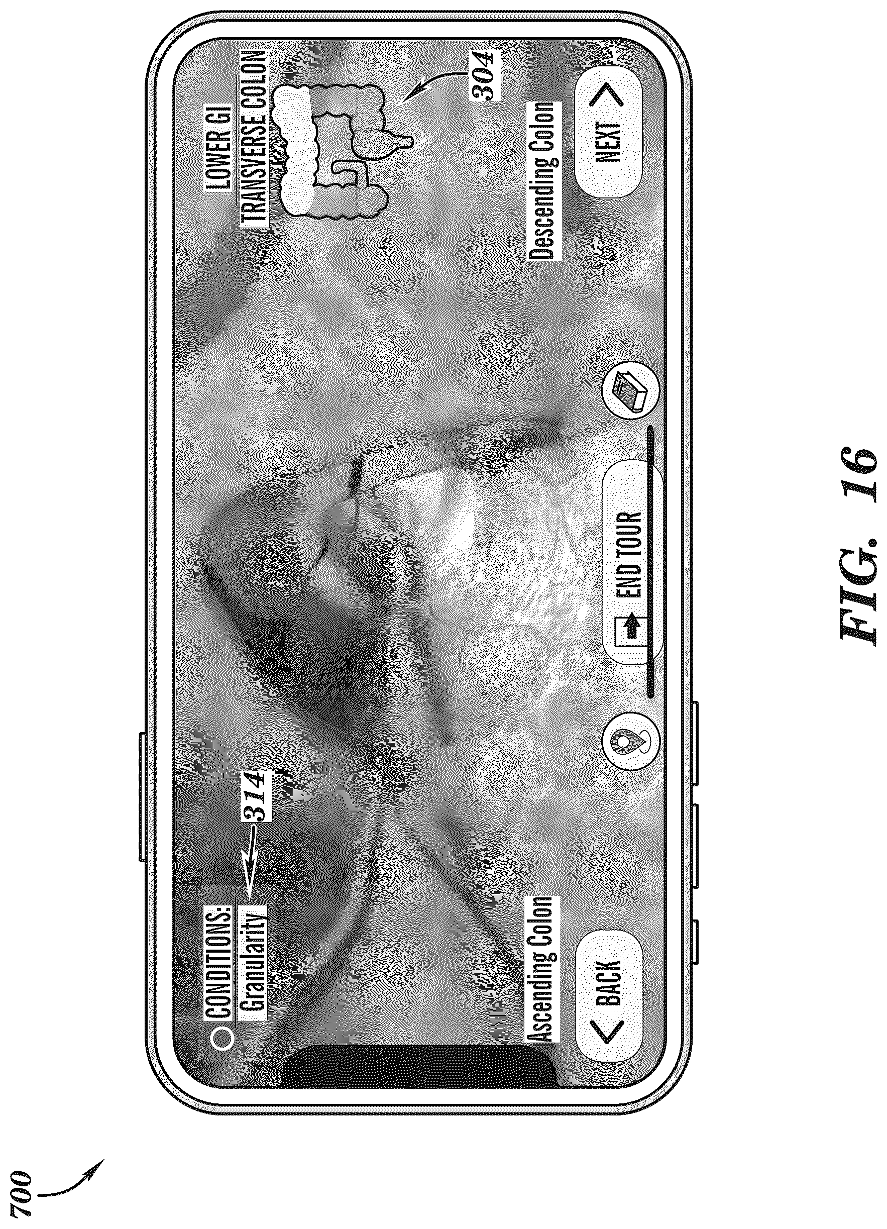 Patent US12308099 Figure 16 – Extended reality medical report generating system