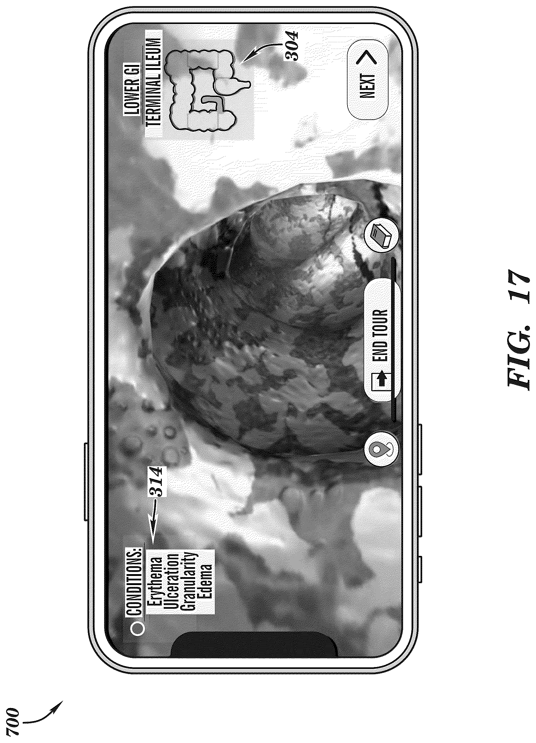 Patent US12308099 Figure 17 – Extended reality medical report generating system