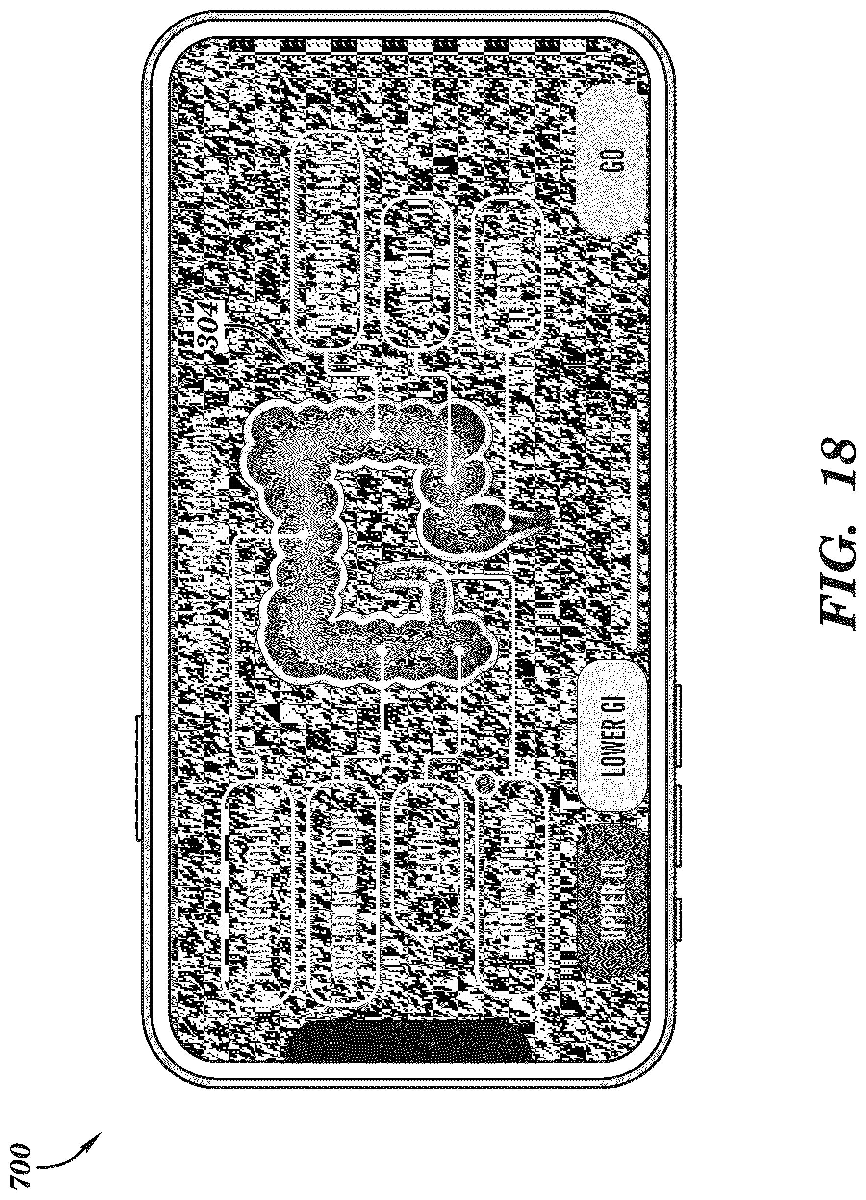 Patent US12308099 Figure 18 – Extended reality medical report generating system