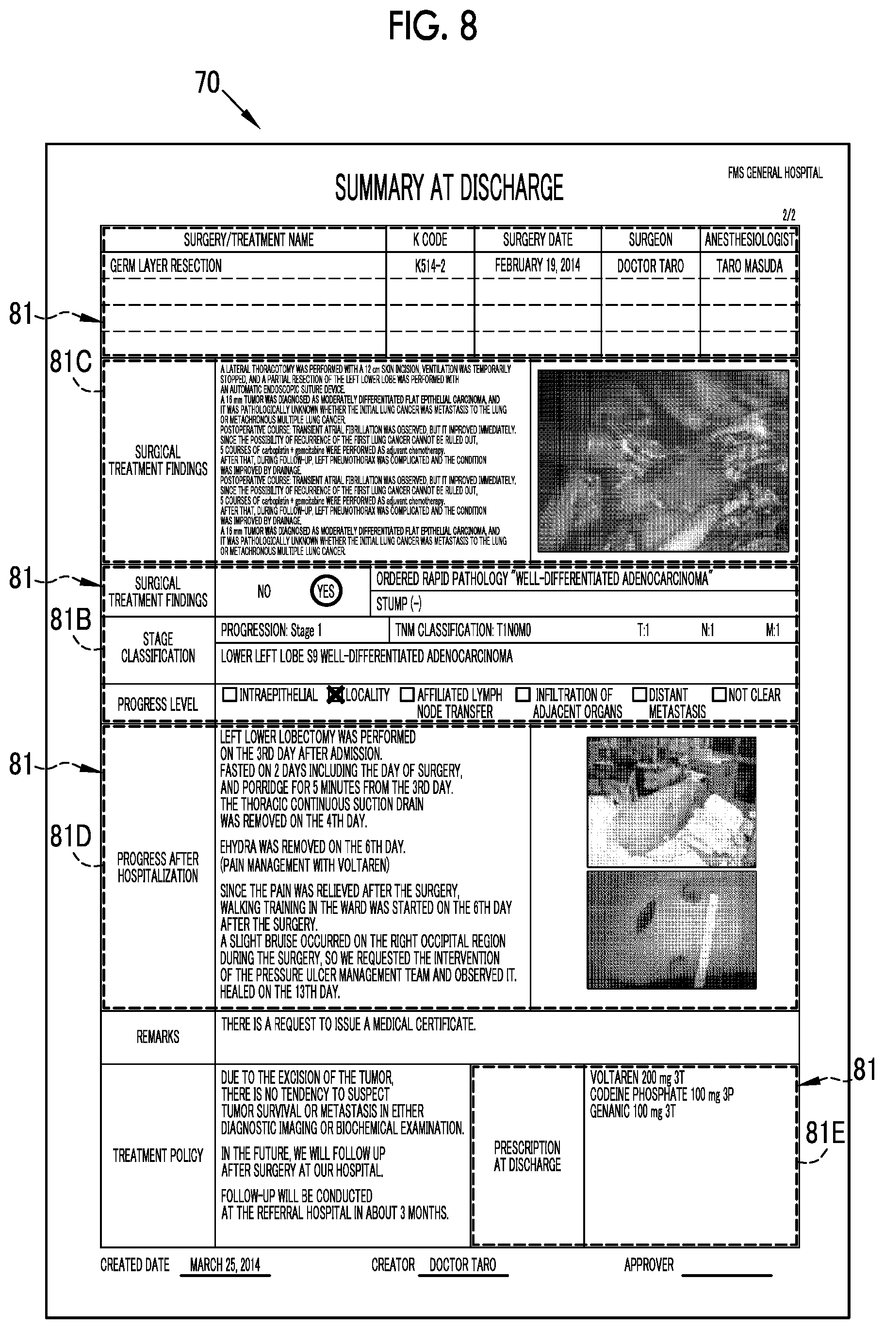 Patent US12308100 Figure 5 – Medical care support device