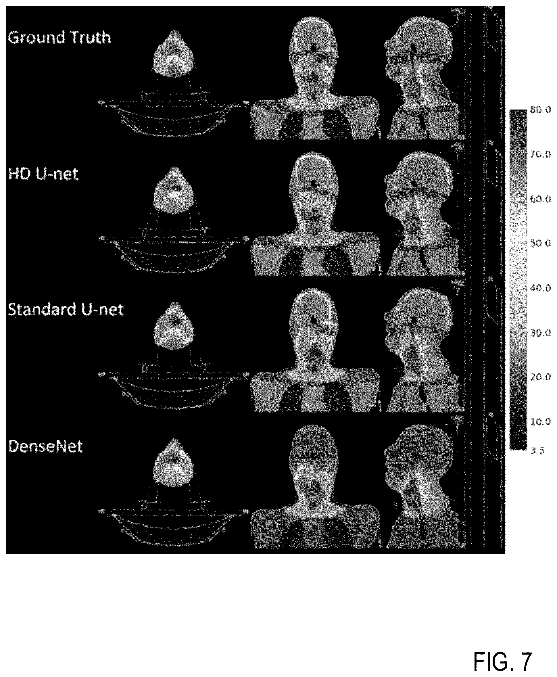 Patent US12308101 Figure 14 – Deep learning based dosed prediction for treatment planning and quality assurance in radiation therapy