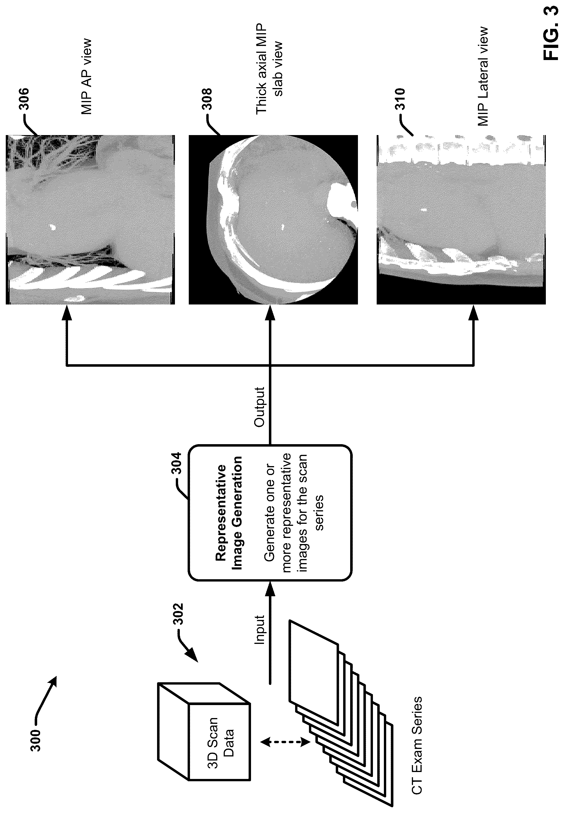 Patent US12308108 Figure 3 – Automatically detecting characteristics of a medical image series