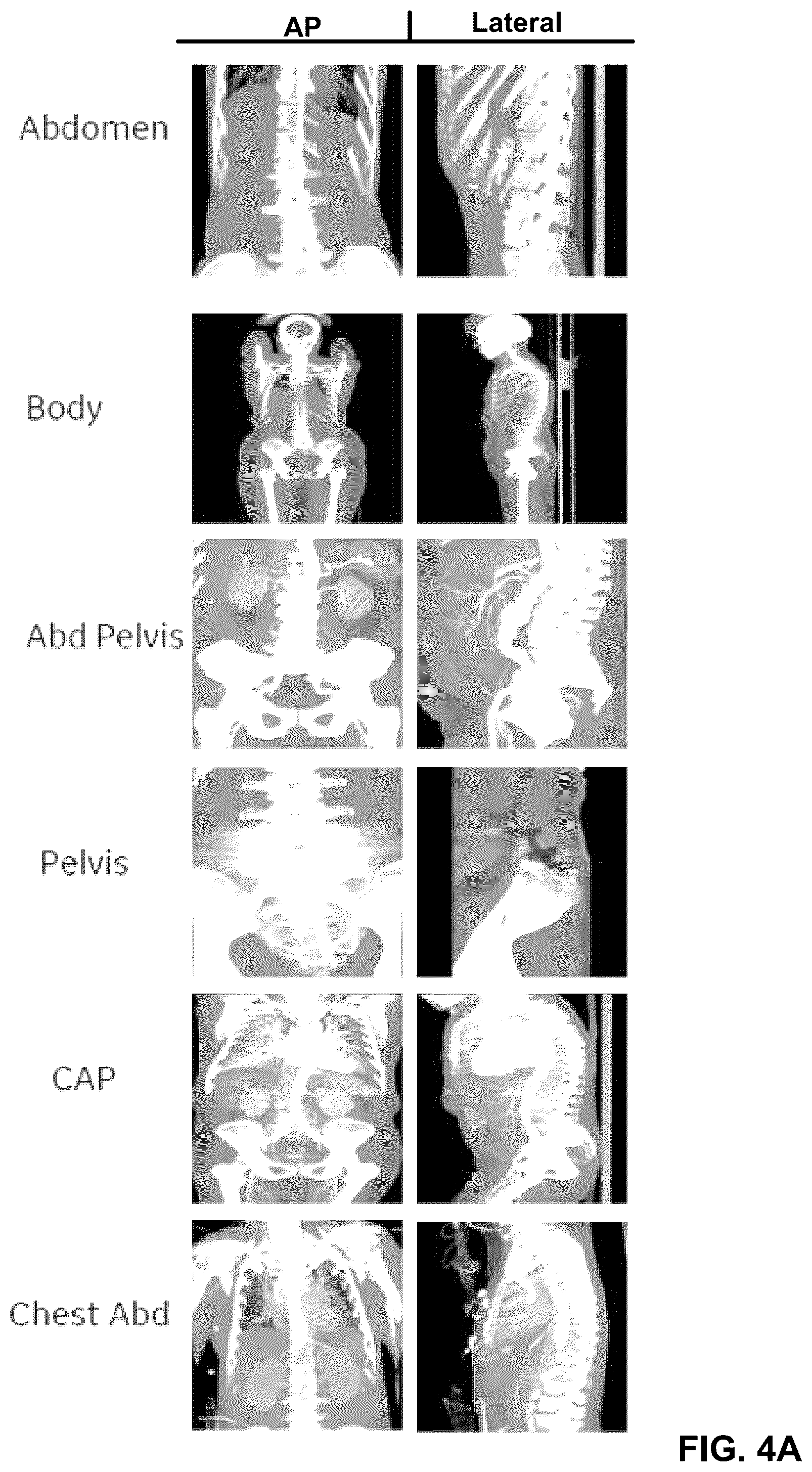 Patent US12308108 Figure 4 – Automatically detecting characteristics of a medical image series