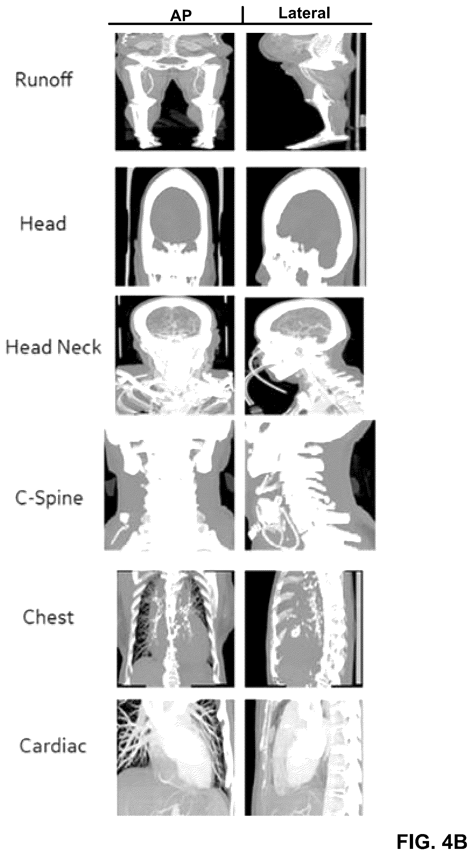 Patent US12308108 Figure 5 – Automatically detecting characteristics of a medical image series