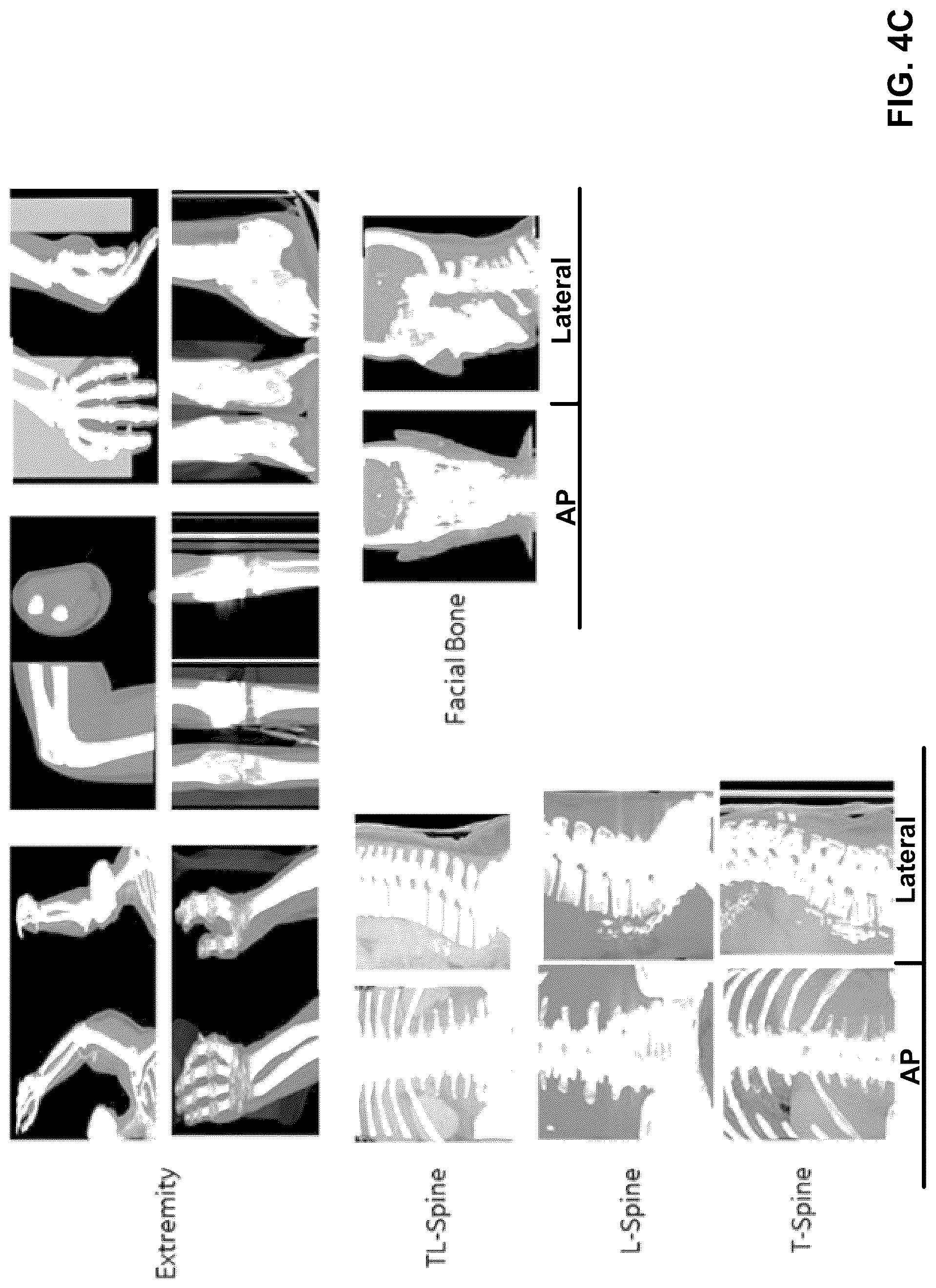Patent US12308108 Figure 6 – Automatically detecting characteristics of a medical image series