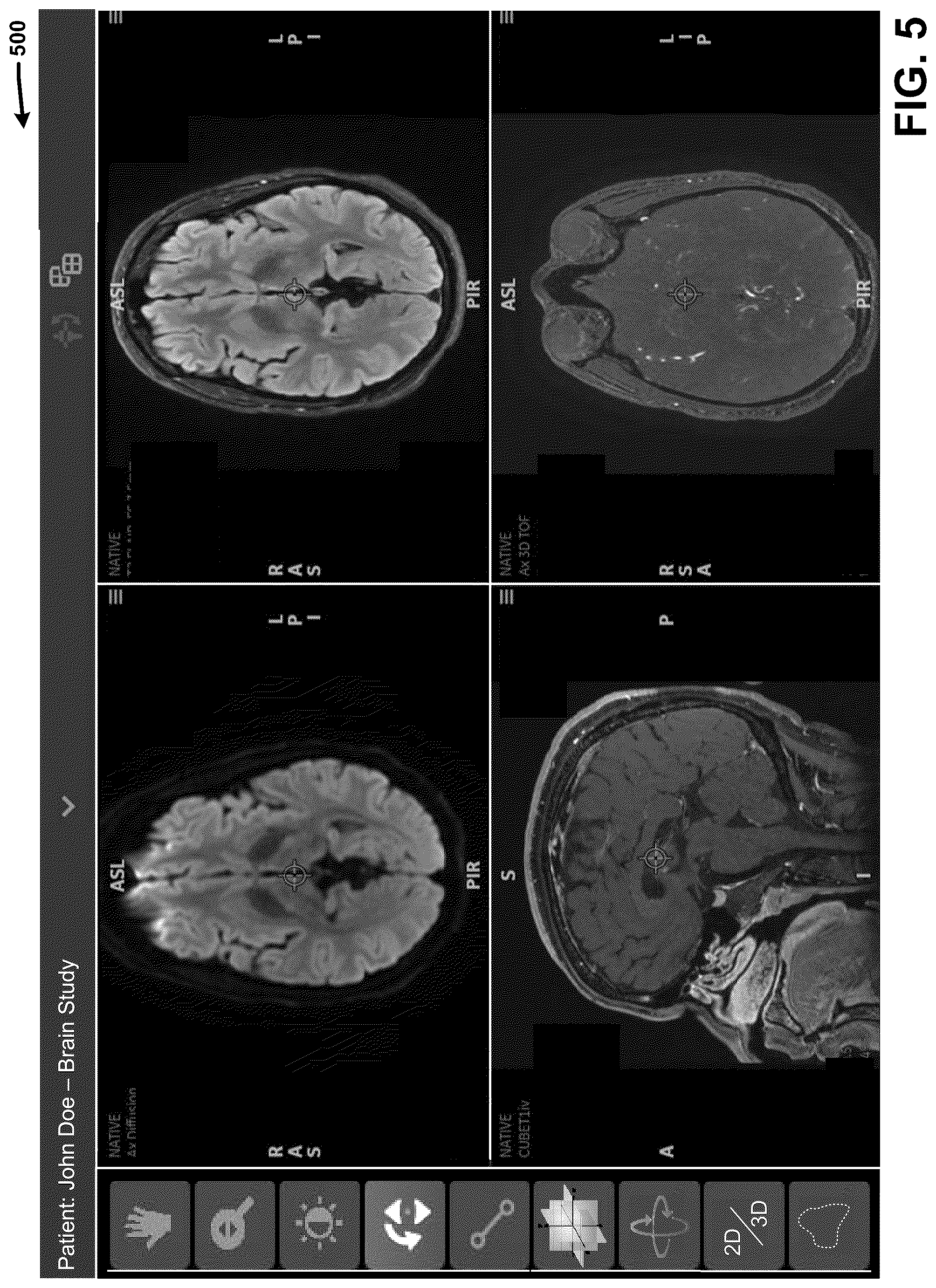 Patent US12308108 Figure 7 – Automatically detecting characteristics of a medical image series