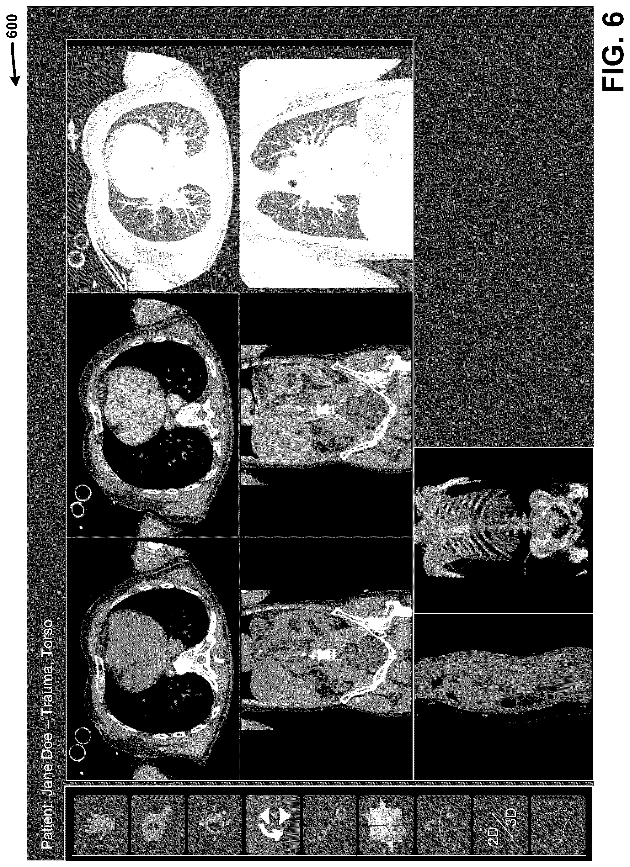 Patent US12308108 Figure 8 – Automatically detecting characteristics of a medical image series