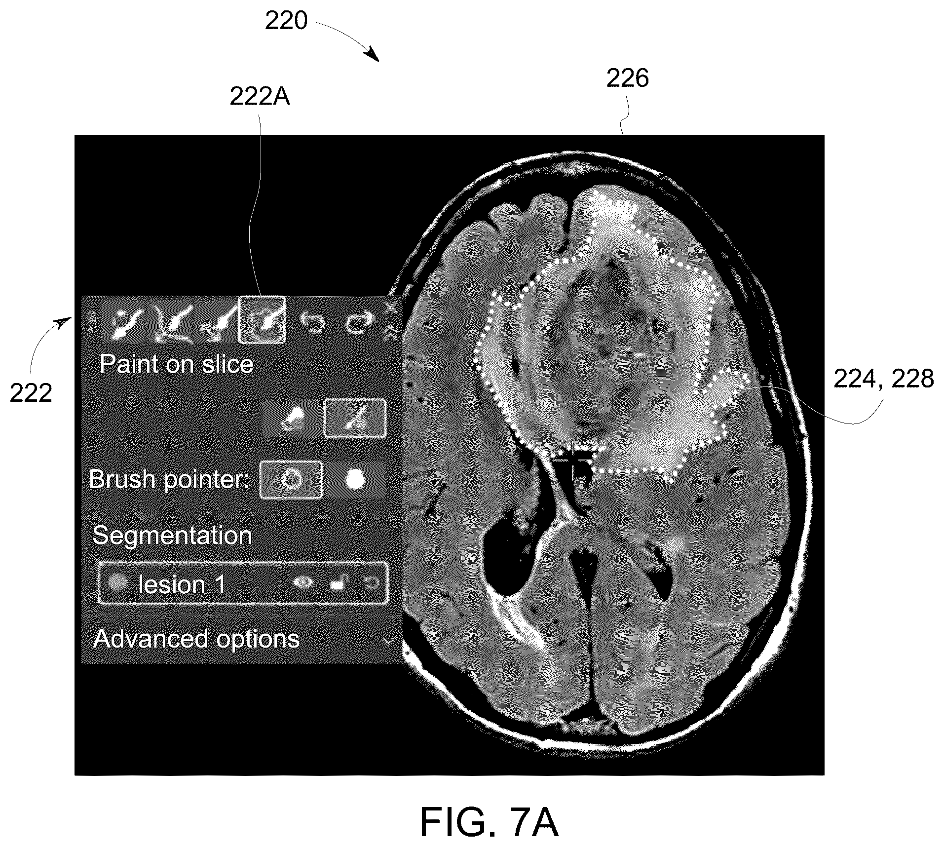 Patent US12308111 Figure 8 – Methods for interactive annotation of medical images in a client-server architecture