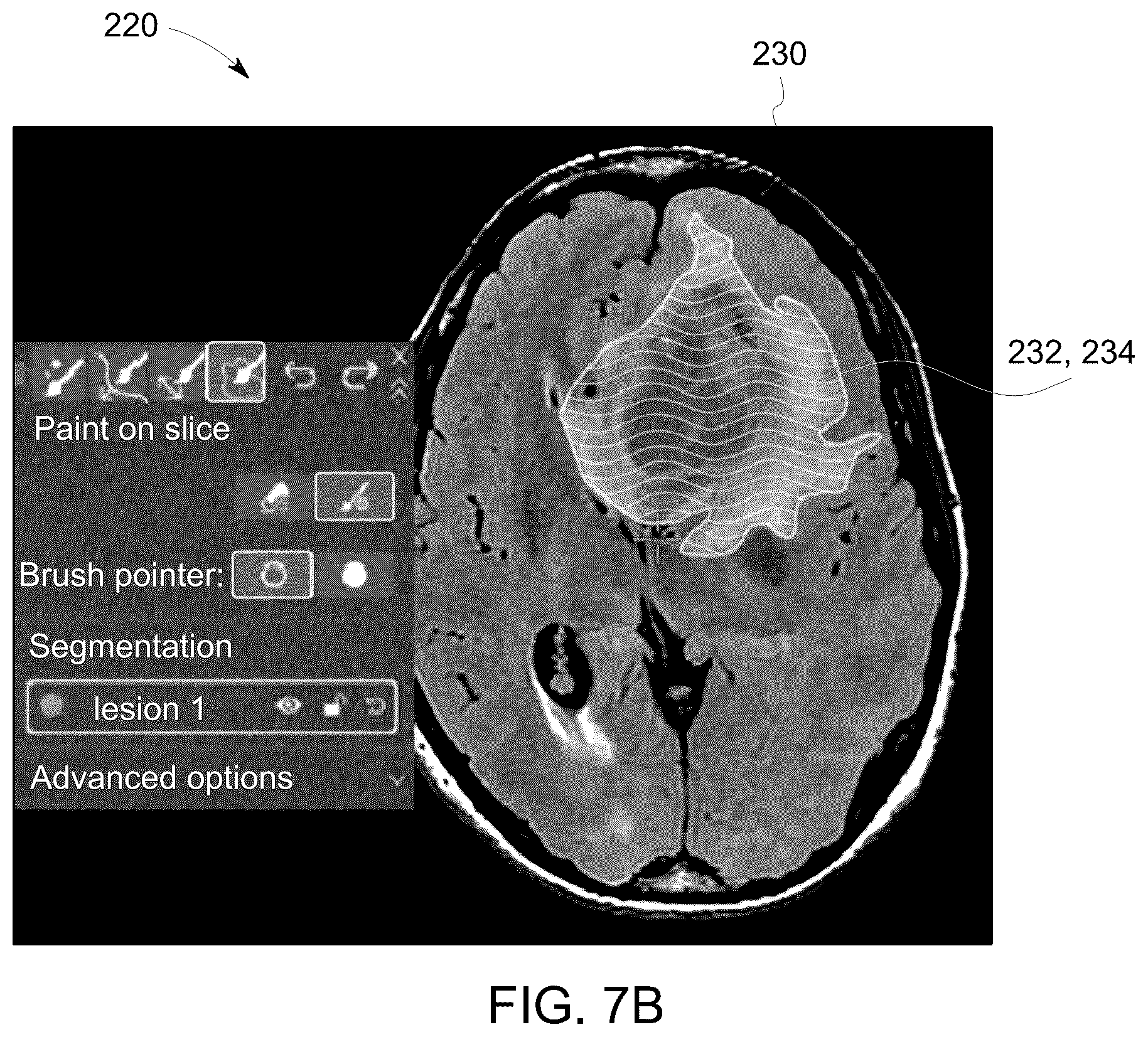 Patent US12308111 Figure 9 – Methods for interactive annotation of medical images in a client-server architecture