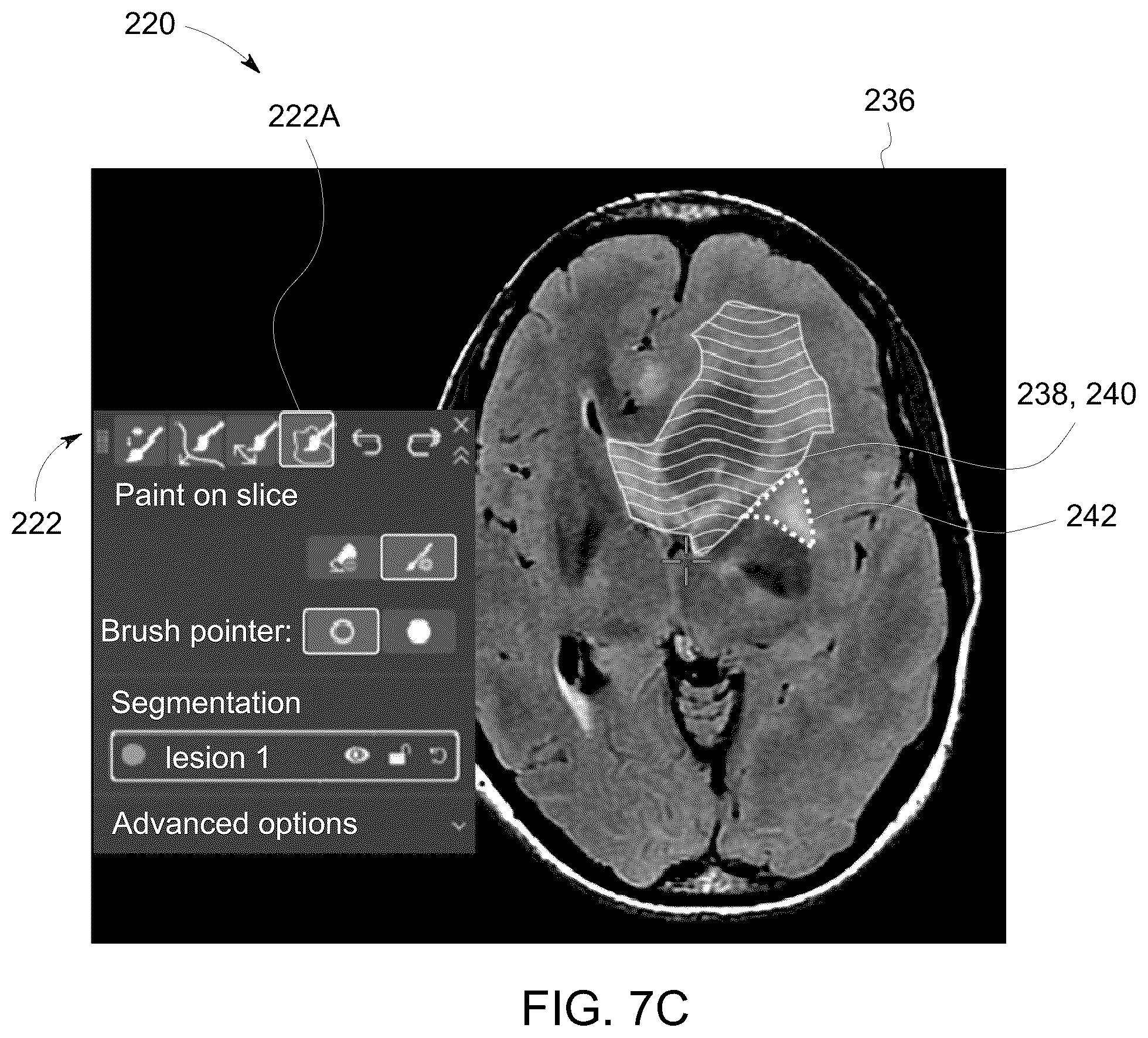 Patent US12308111 Figure 10 – Methods for interactive annotation of medical images in a client-server architecture