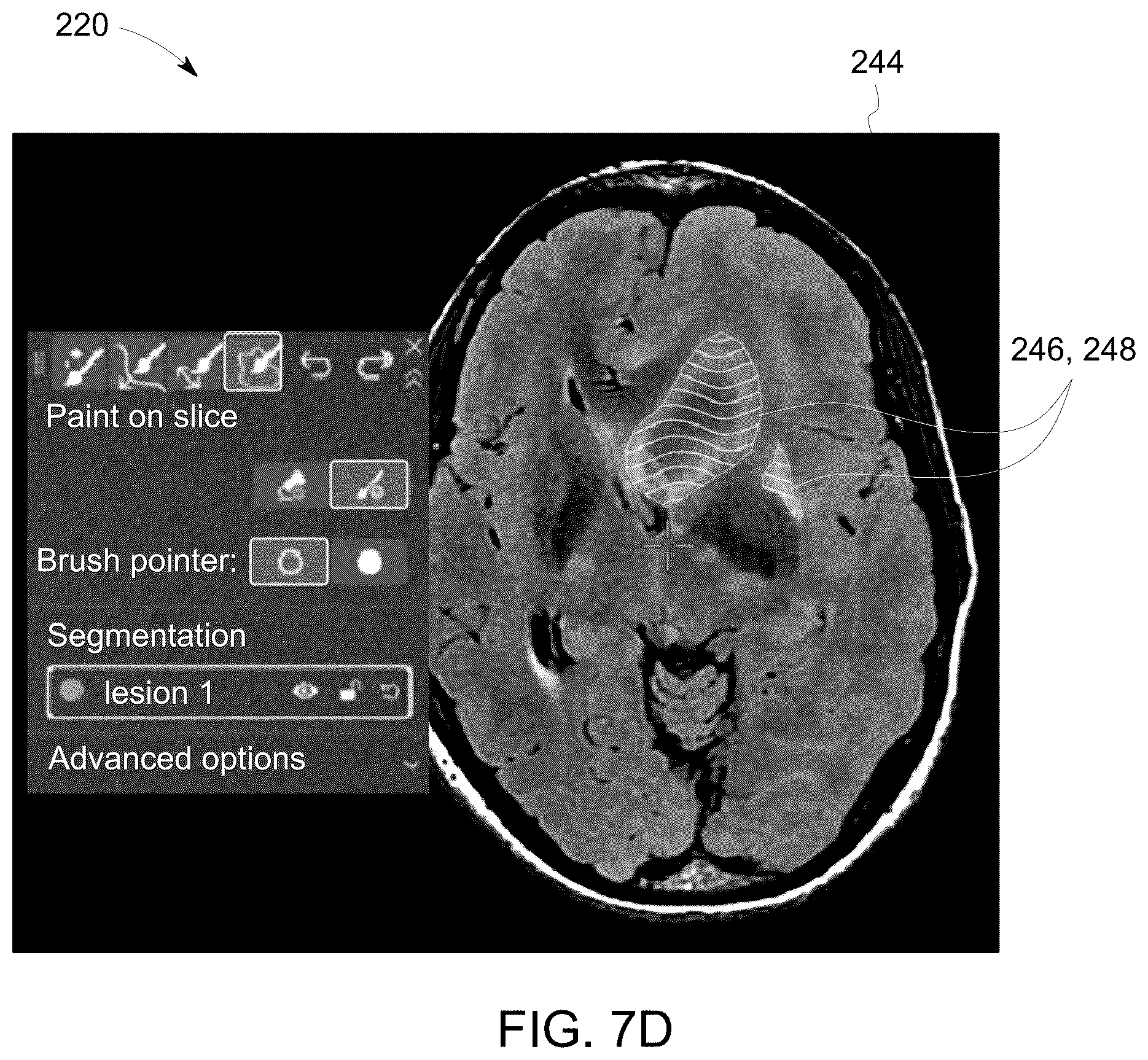 Patent US12308111 Figure 11 – Methods for interactive annotation of medical images in a client-server architecture