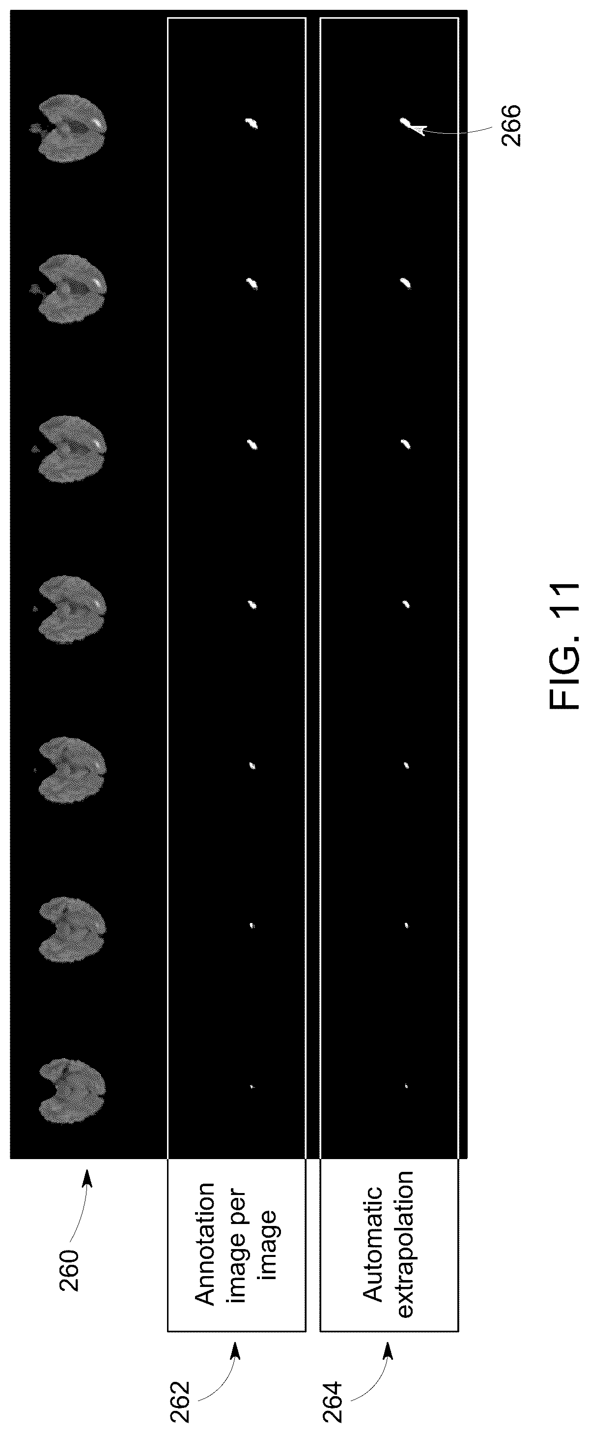 Patent US12308111 Figure 15 – Methods for interactive annotation of medical images in a client-server architecture