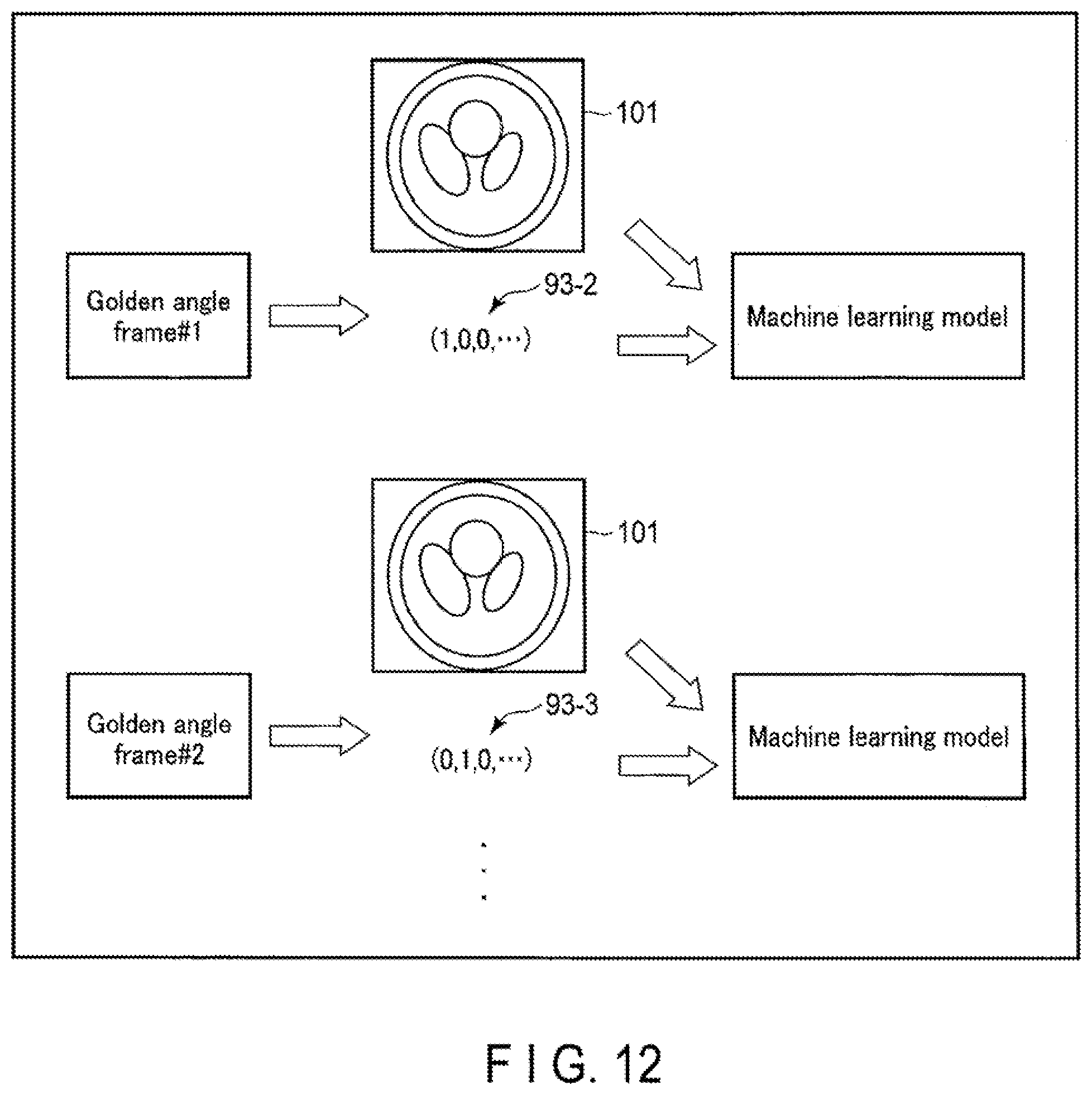 Patent US12308112 Figure 11 – Medical information processing apparatus and medical information processing method