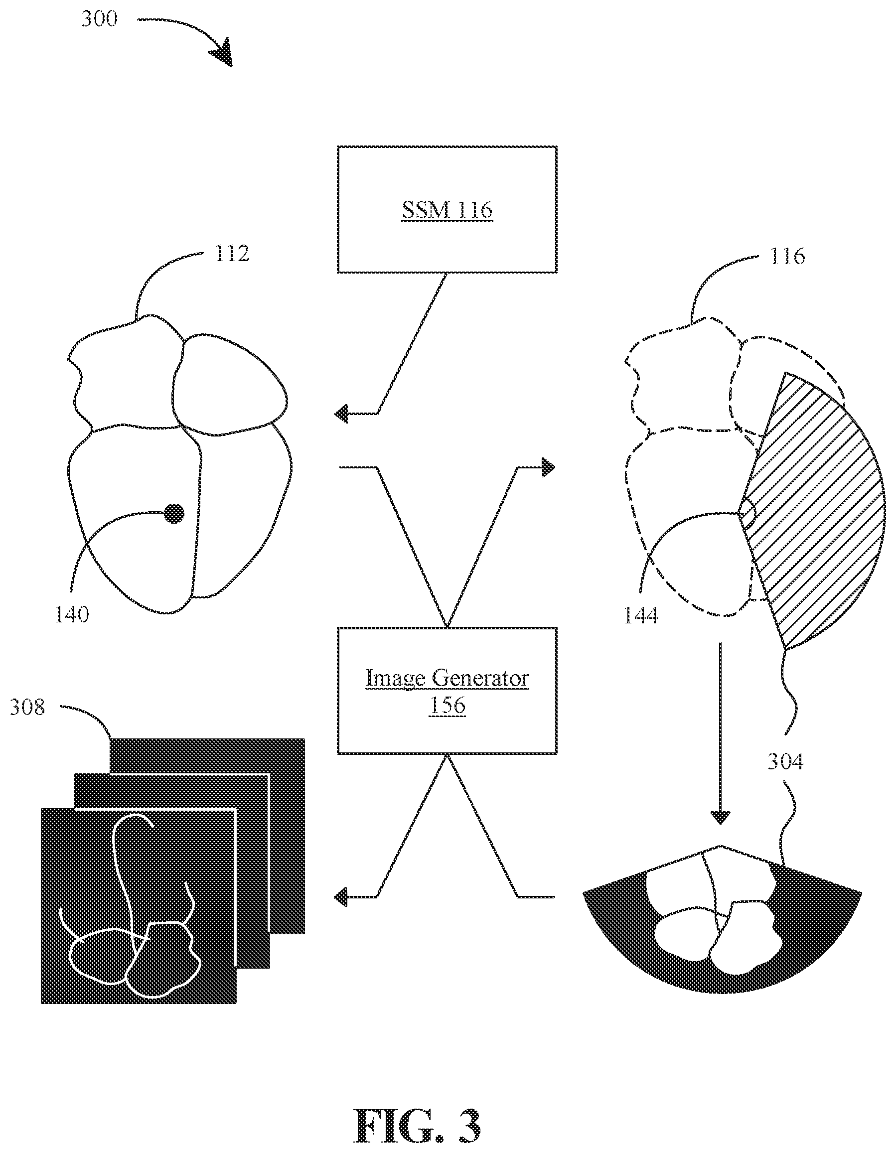 Patent US12308113 Figure 3 – Apparatus and methods for synthetizing medical images