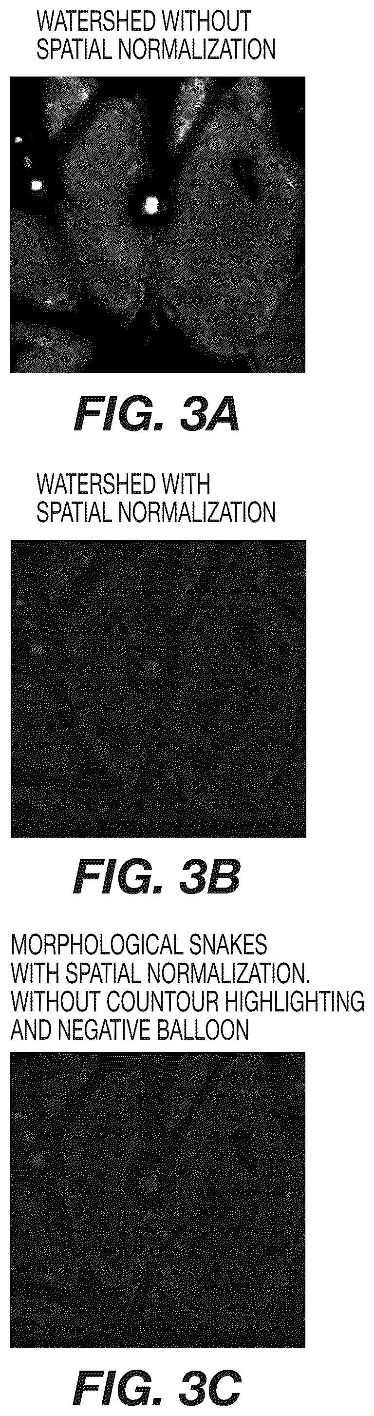 Patent US12308120 Figure 4 – Analysis and characterization of epithelial tissue structure