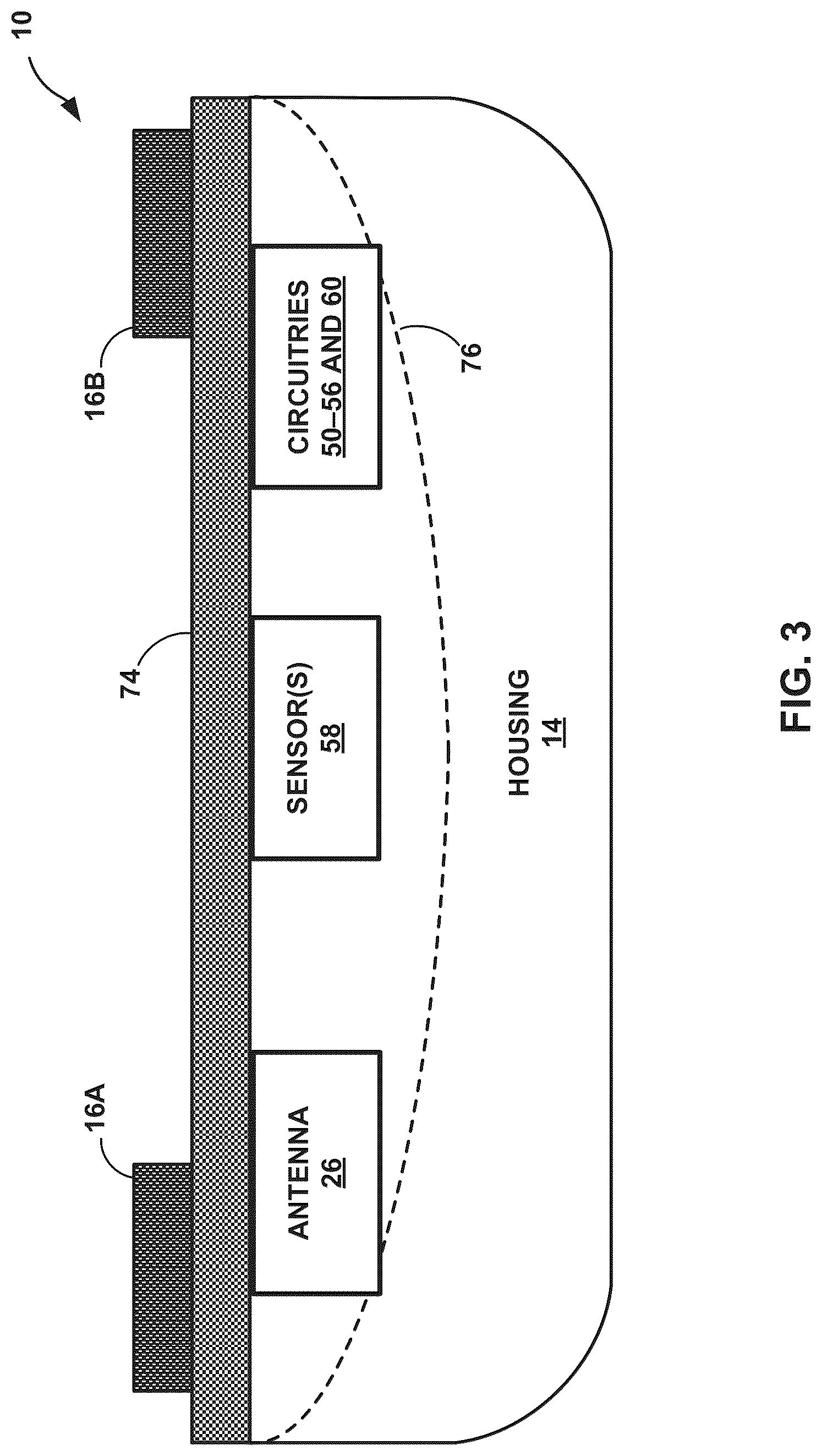 Patent US12308121 Figure 3 – Machine learning based depolarization identification and arrhythmia localization visualization