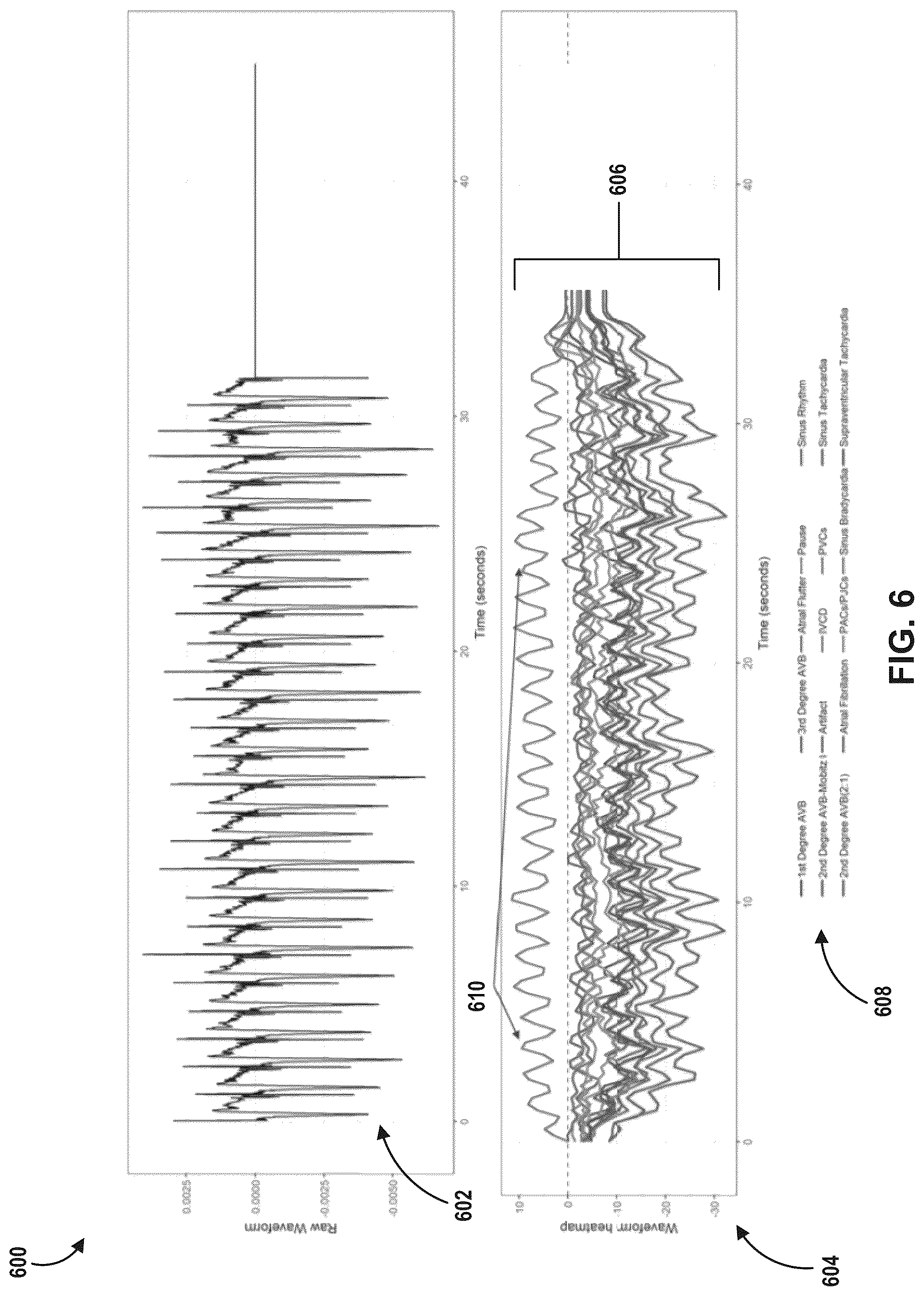 Patent US12308121 Figure 6 – Machine learning based depolarization identification and arrhythmia localization visualization