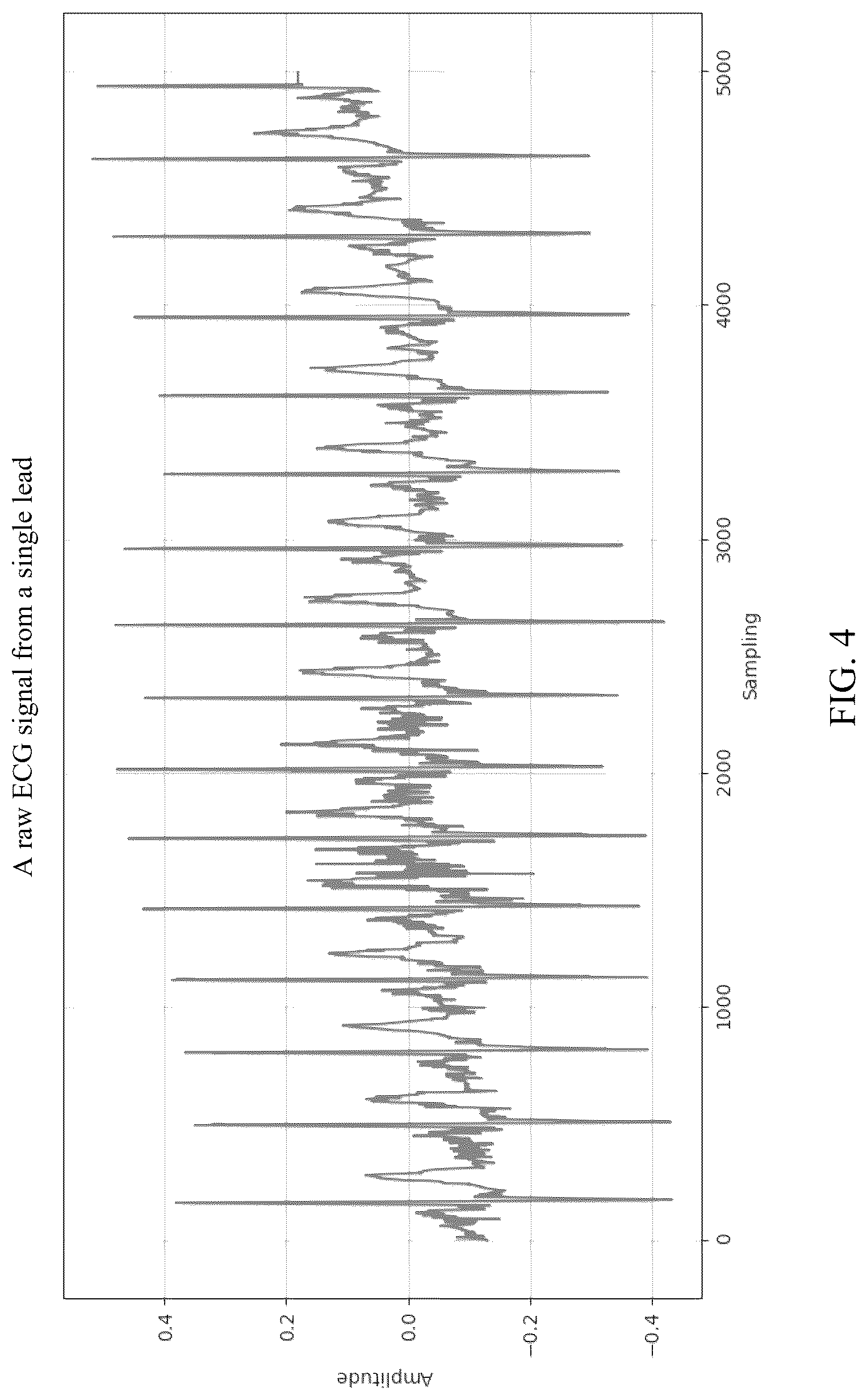 Patent US12308123 Figure 4 – Electrocardiogram (ECG) signal classification method based on contrastive learning and multi-scale feature extraction