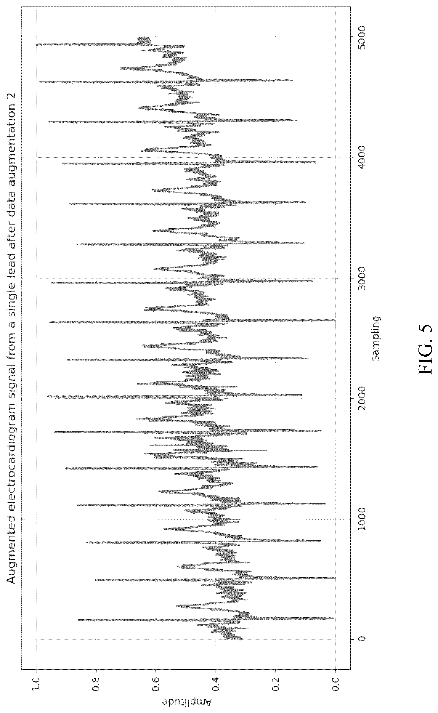 Patent US12308123 Figure 5 – Electrocardiogram (ECG) signal classification method based on contrastive learning and multi-scale feature extraction