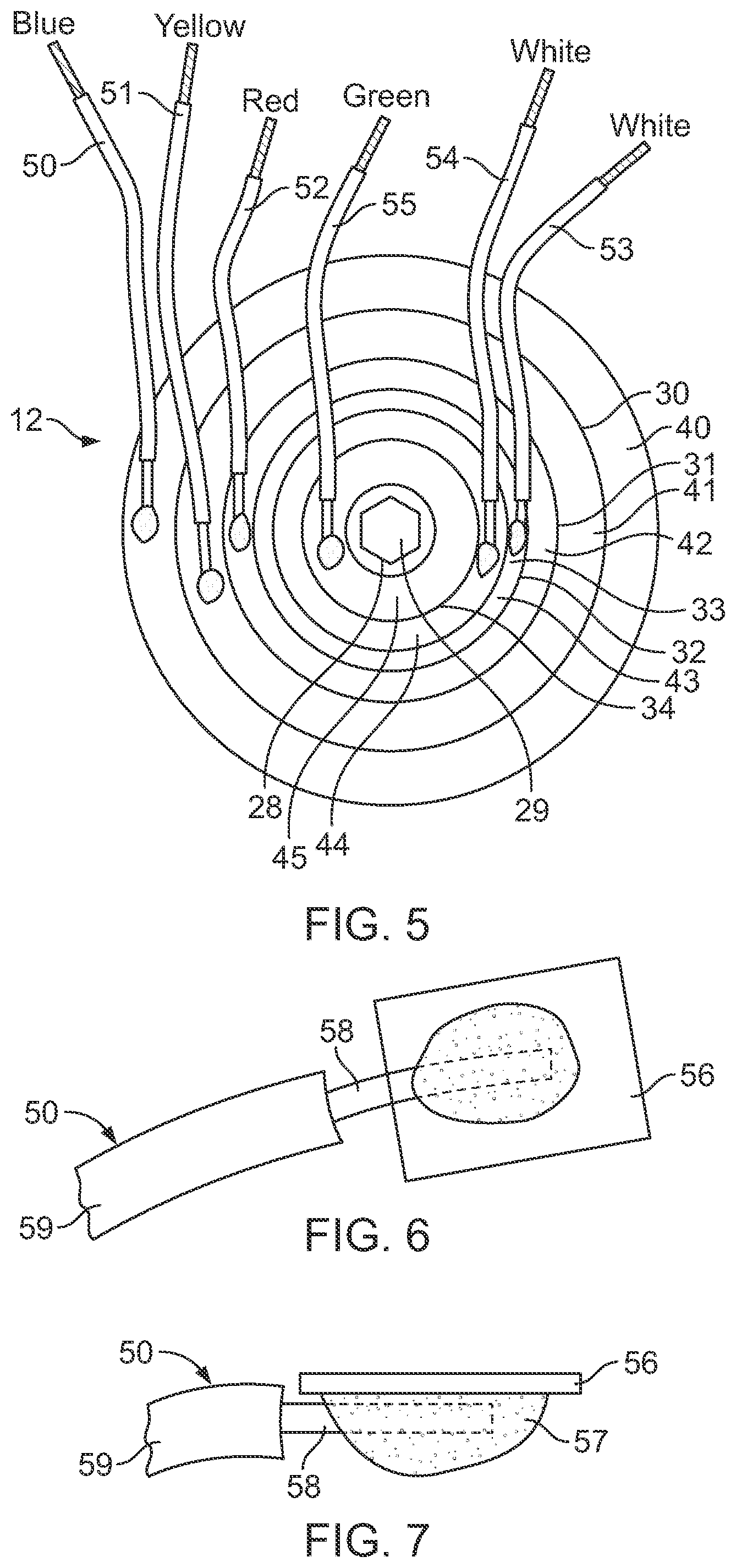 Patent US12308179 Figure 5 – Capacitor with multiple elements for multiple replacement applications