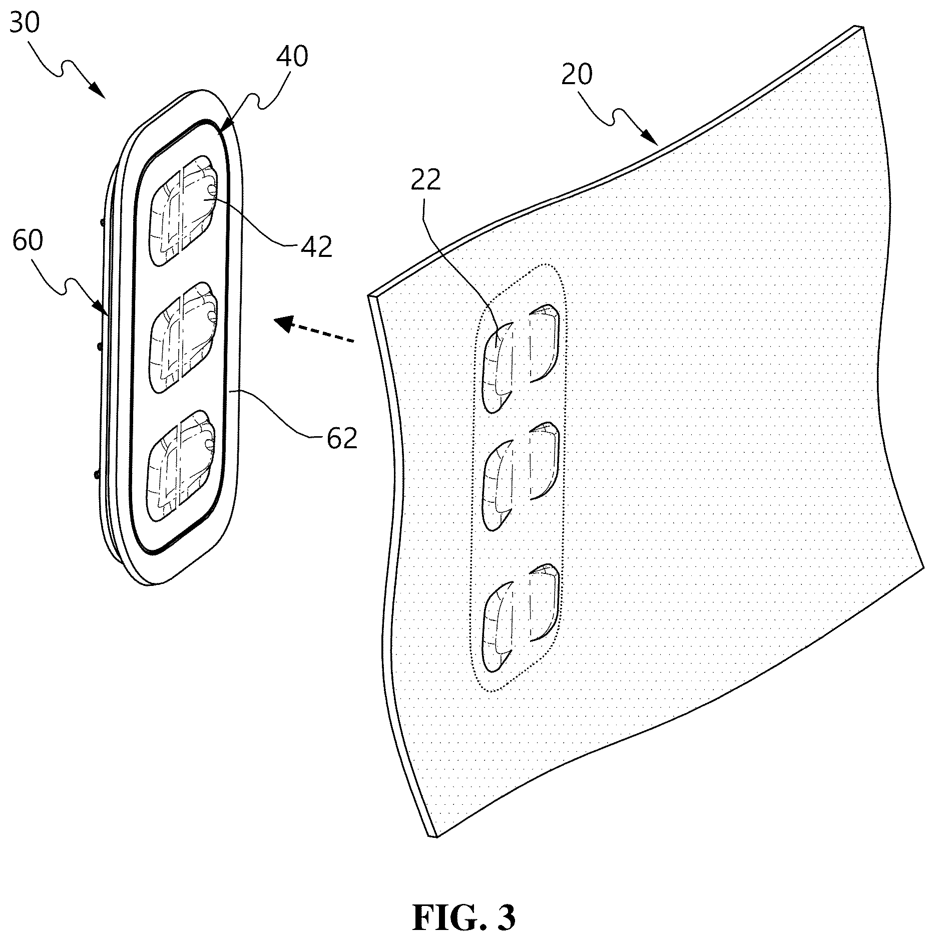 Patent US12308184 Figure 5 – In-vehicle operation button installation structure