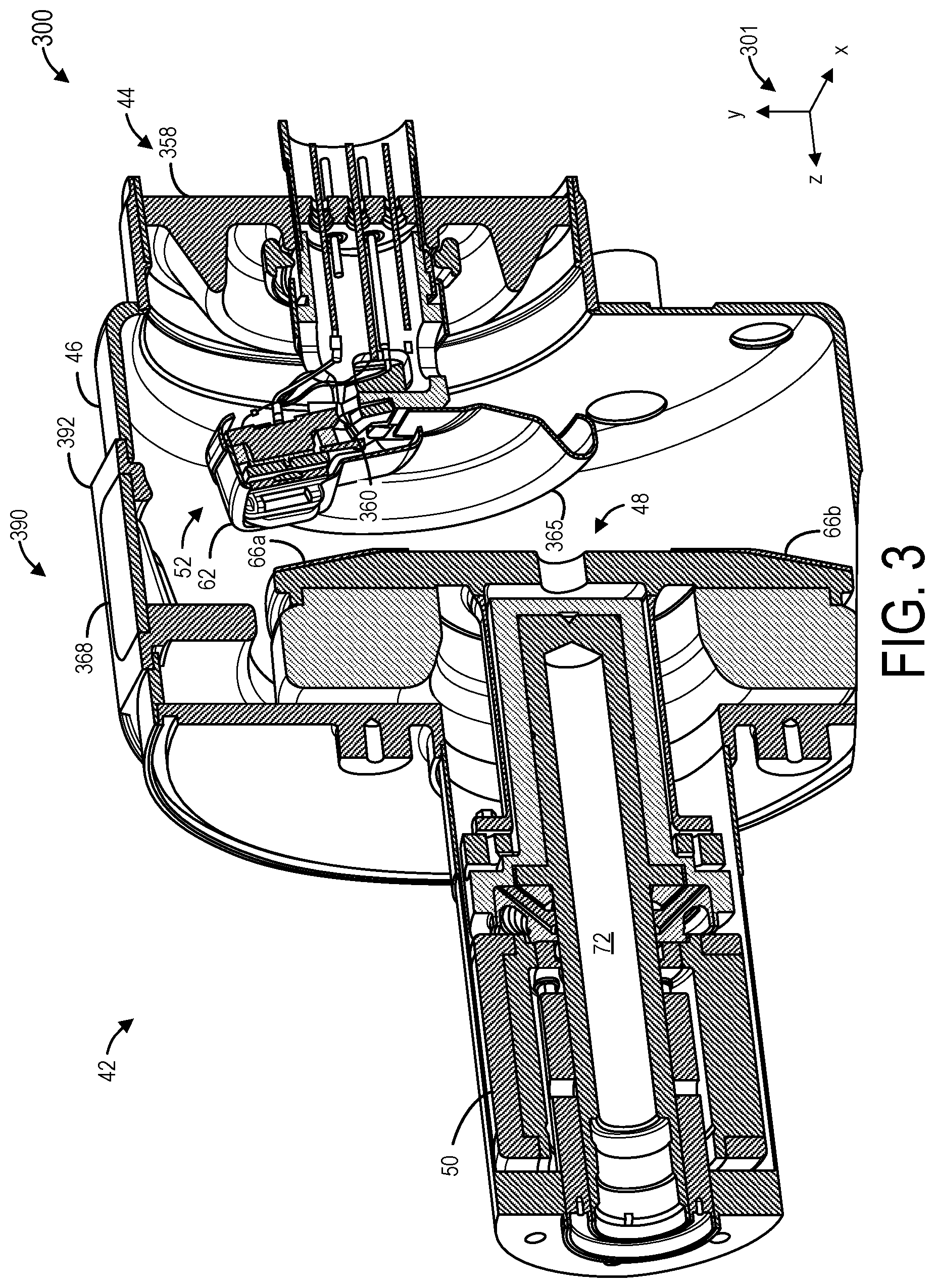 Patent US12308199 Figure 3 – X-ray cathode focusing element