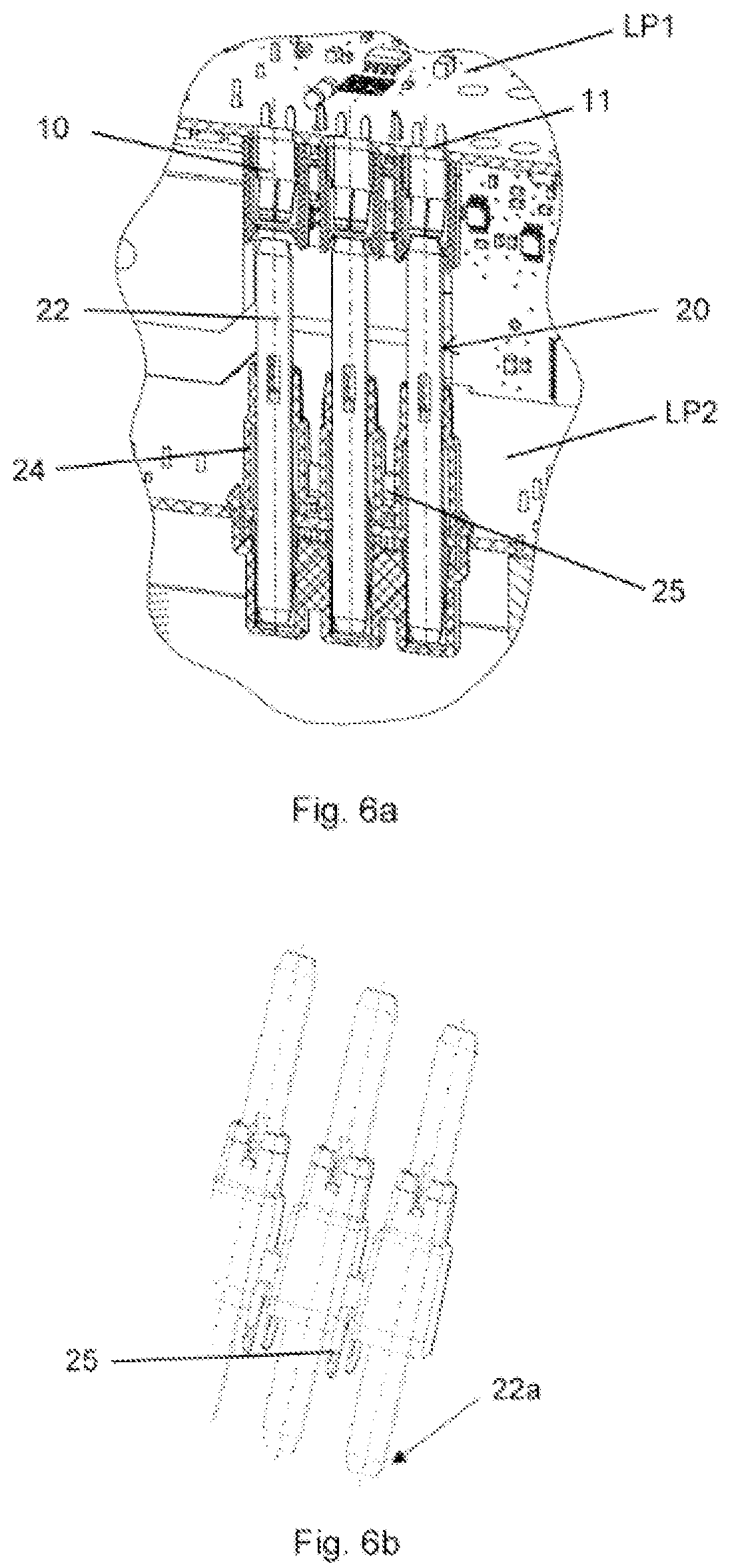 Patent US12308725 Figure 4 – Modular circuit board arrangement and method for assembling a circuit board arrangement
